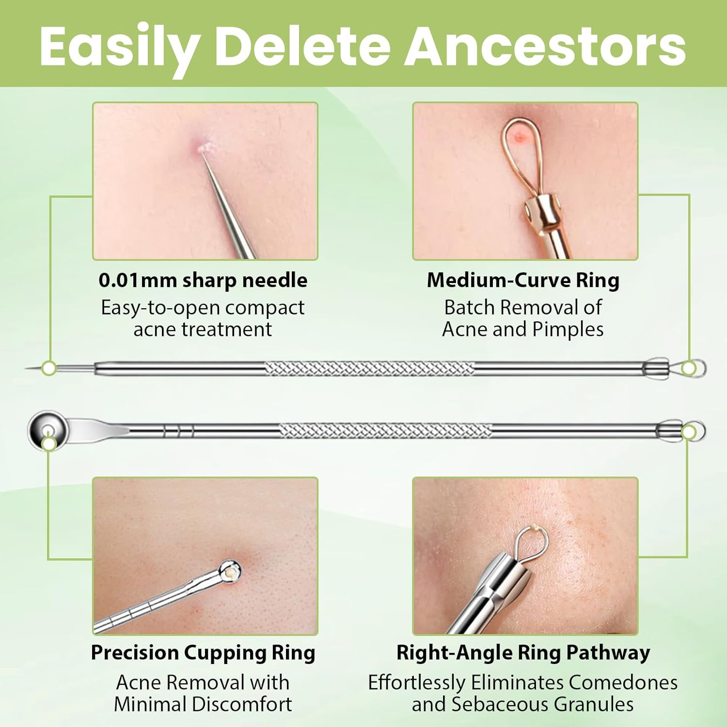 9 Pcs Blackhead Remover Kit - Acne Removal Popper Tool Sets for Blackheads, Whiteheads, Zits & Blemishes, Premium Stainless Steel Comedone Extractor with Portable Leather Case for Skin Care image number 1