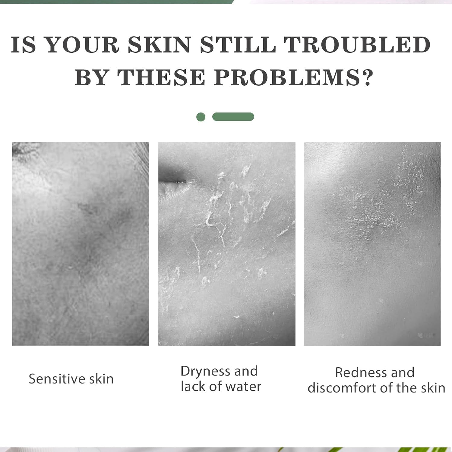 Hypochlorous Acid Face and Skin Spray,Safe for Use on Acne Prone Skin, Dry Scalp, Toner, Eye Lash Cleanser, Face and Hand Cleanser - 100Ml image number 1