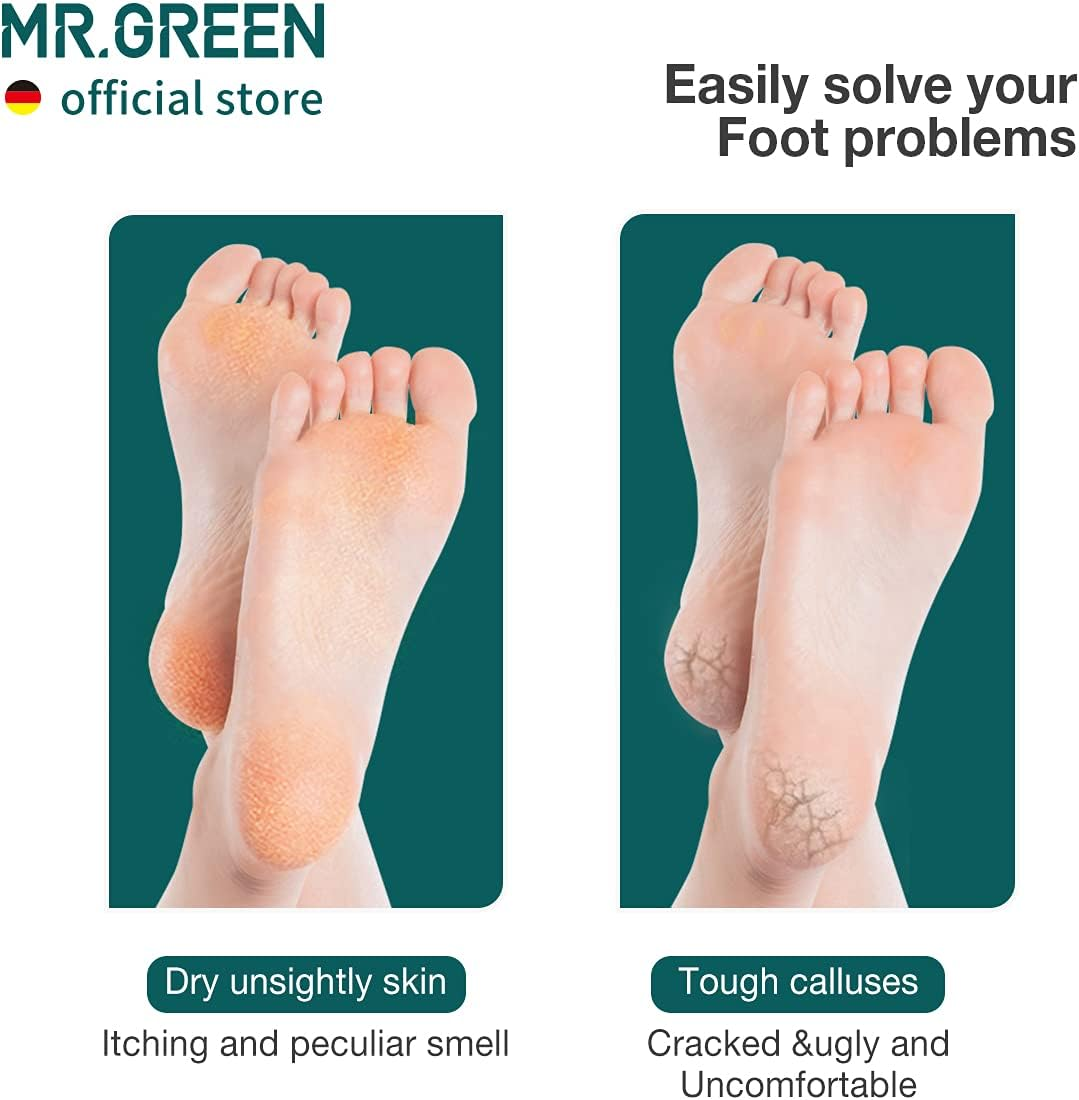 MR.GREEN Foot File Double Sided Pedicure Foot Care Tools Professional Callus Remover Foot Rasp Stainless Steel Foot Scrubber for Feet (Green) image number 4