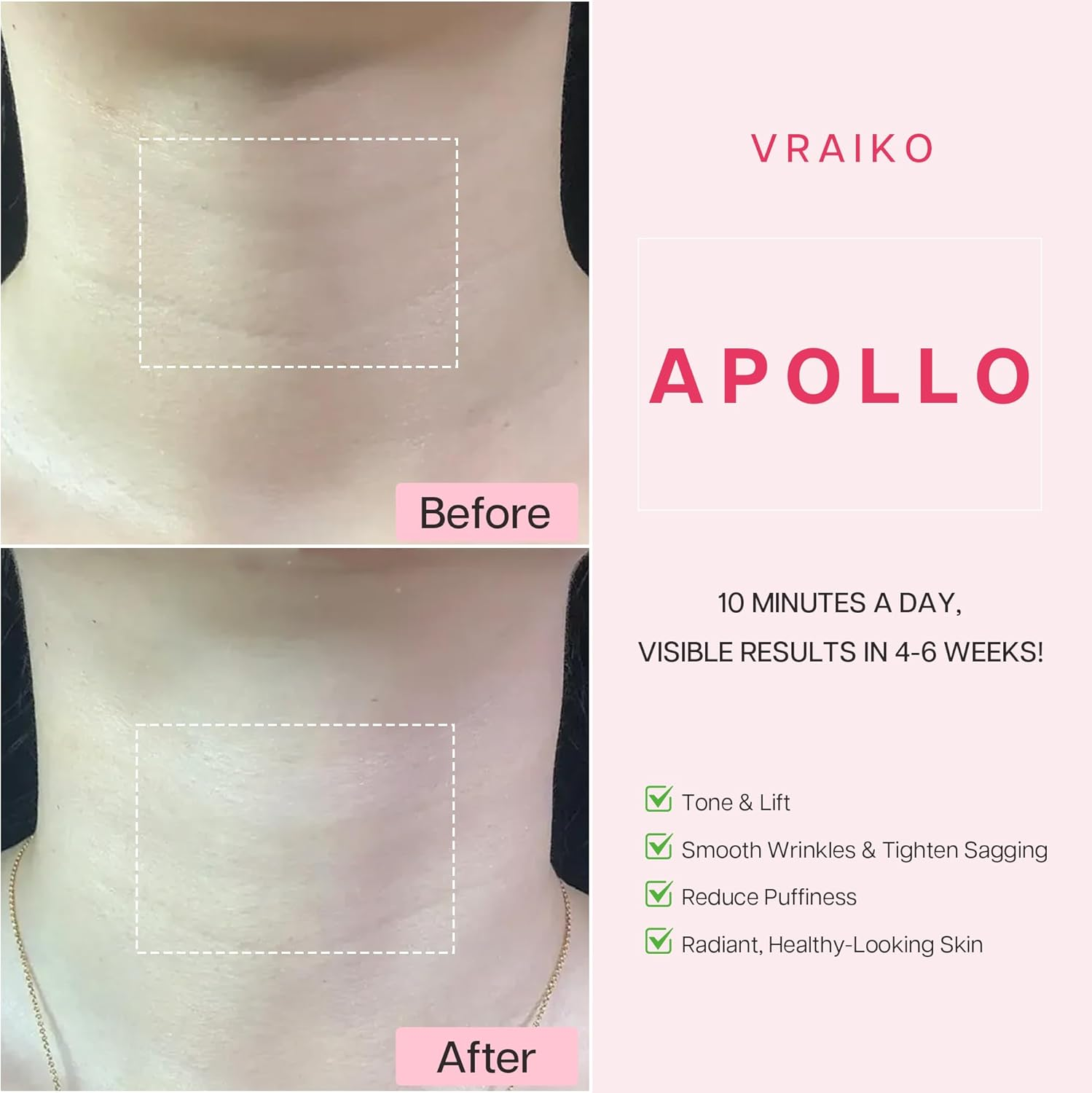 VRAIKO APOLLO Neck Lifting Massager, Microcurrent Face Neck Sculpting Device with Dual-Action LED Care, IP65 Waterproof, for Contouring, Enhanced Absorption, Radiance and Elasticity