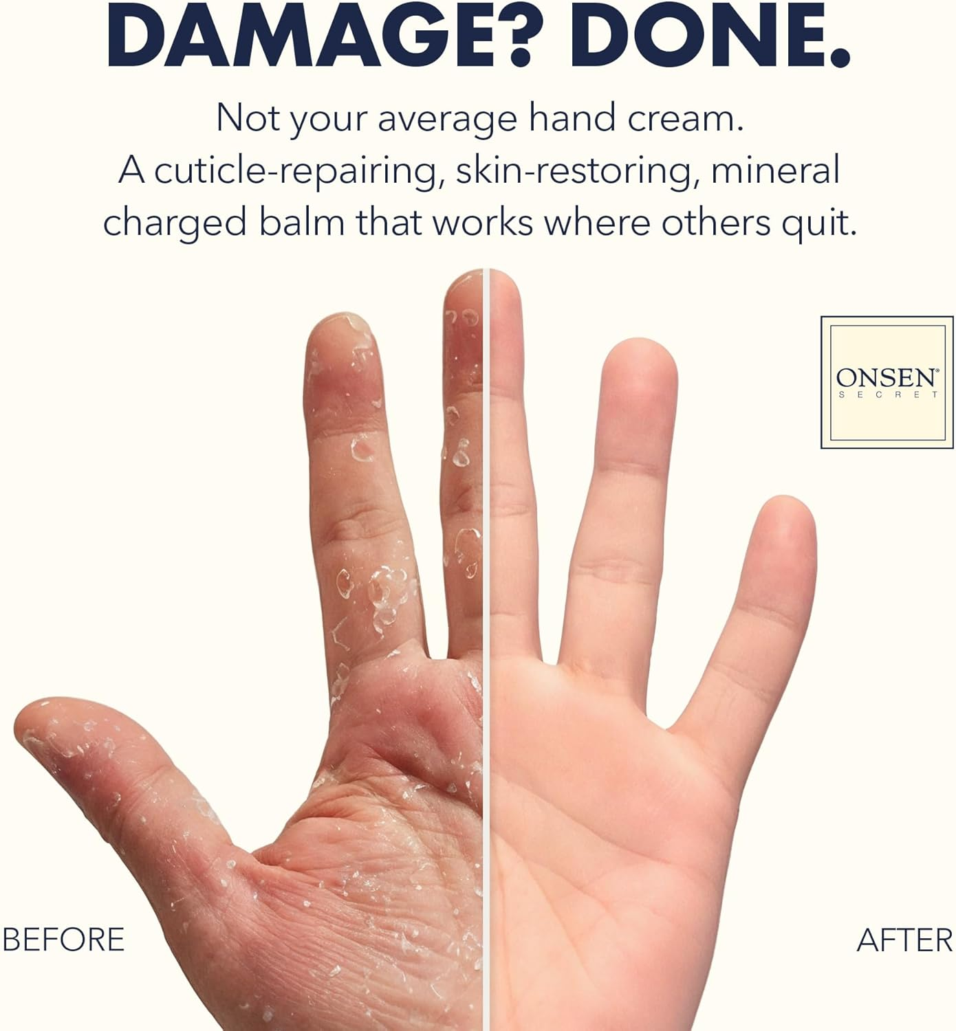 Onsen Hand & Cuticle Rescue Cream | Organic Nail Strengthener & Balm | Dry, Cracked Hands, Elbows & Feet | Shea Butter, Tsubaki & Jojoba Oil | Nail Repair & Growth, Vegan &ndash; 1 Pack (26Ml) image number 4