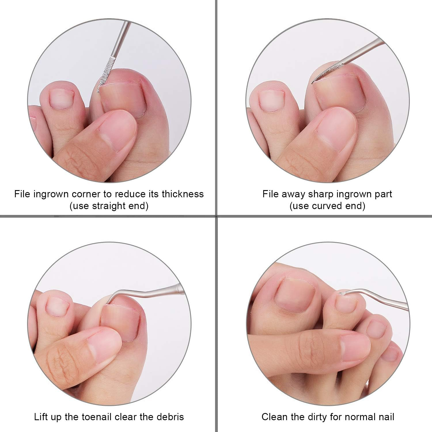 2PCS Ingrown Toenail File and Lifter with Storage Case,Yinyin100% Stainless Steel Ingrown Toenail Tool,Double Sided Professional Grade Nail Cleaner Tool image number 1