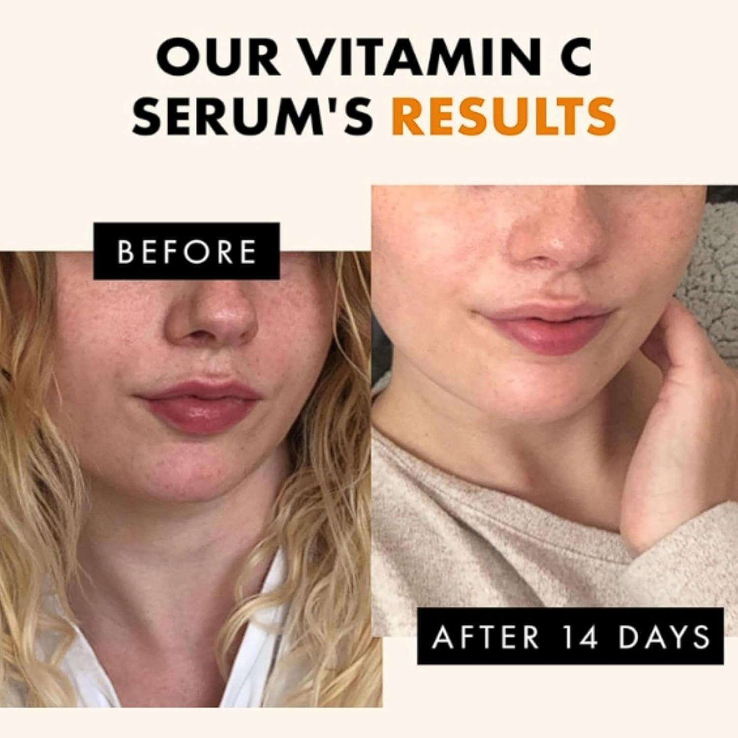 Turmeric and Vitamin C Serum for Face, Dark Spot Corrector, Brightening Facial Serum, Anti-Aging Serum with Hyaluronic Acid, Acne Scar Remover, Skin Tone Repair, Glow Booster, Daily Hydration (2Pcs)