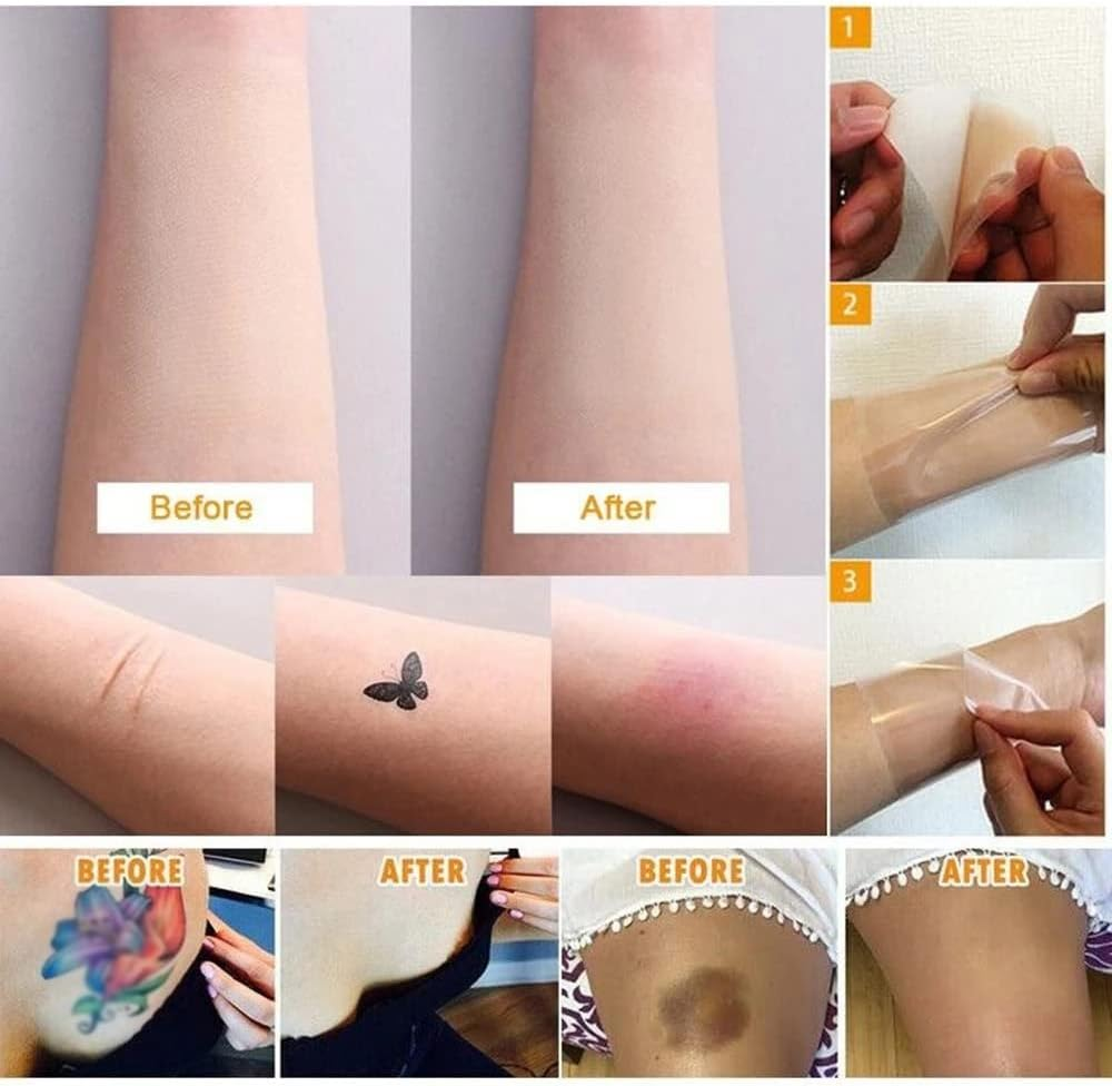 5X Tattoo Scar Acne Cover Cover up Sticker Birthmark Waterproof Hide Tape Normal Skin Tone - 5X Light Skin Tone image number 2