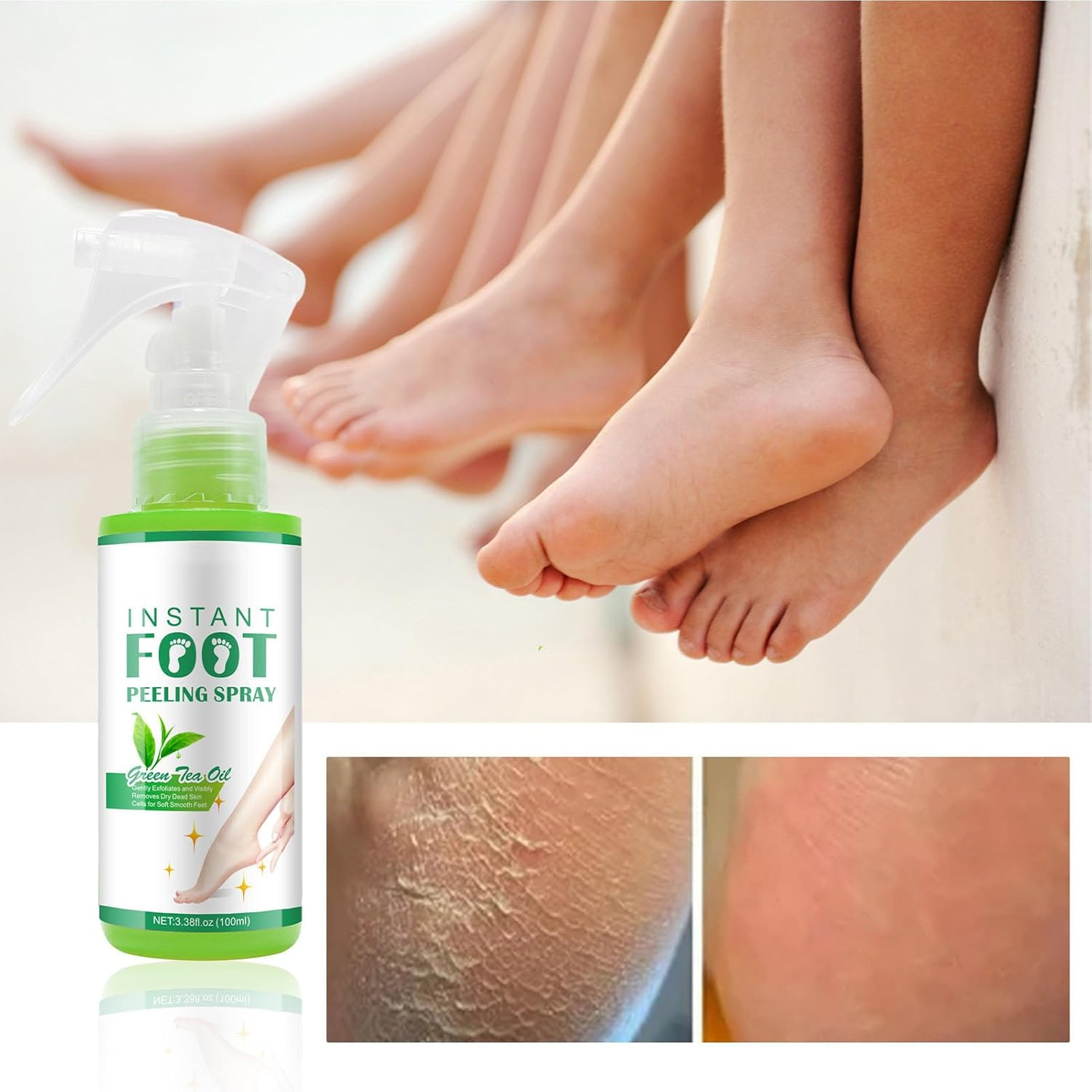 Foot Peel Spray | 100Ml Foot Peeling Spray for Most Skin Types,Pedicure Dead Skin Exfoliator for Cracked Rough Heels, Dry Toe Skin image number 3