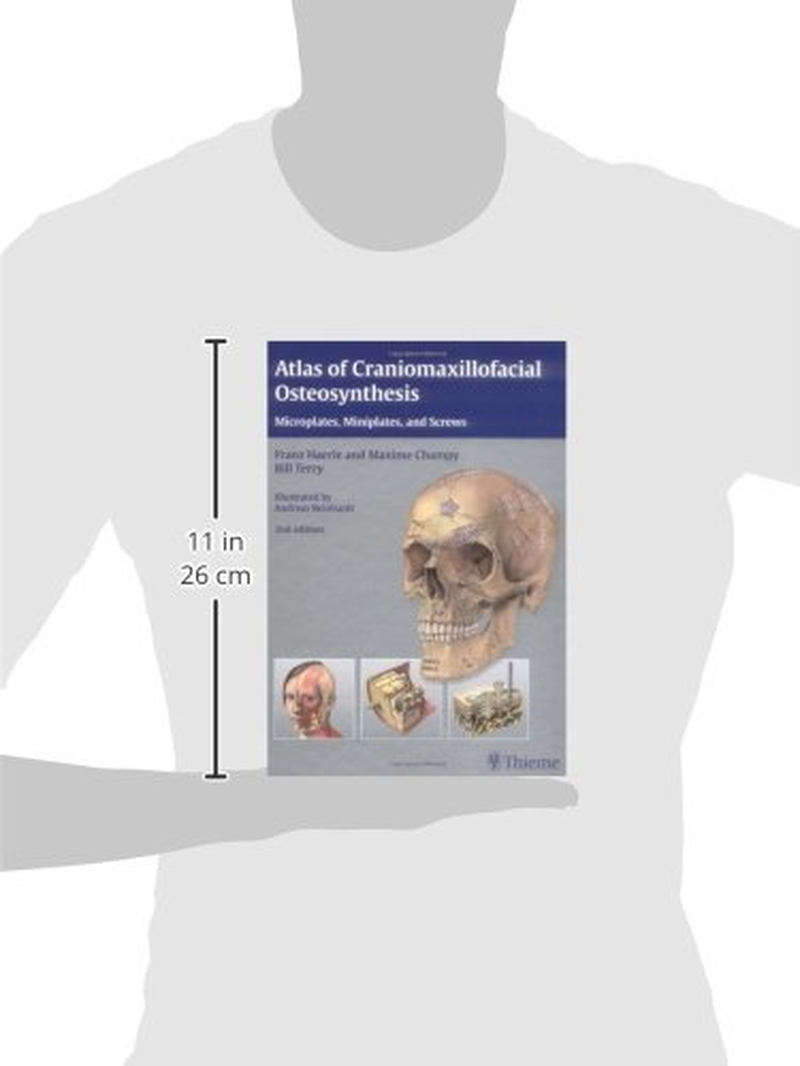 Atlas of Craniomaxillofacial Osteosynthesis: Microplates, Miniplates,And Screws image number 1