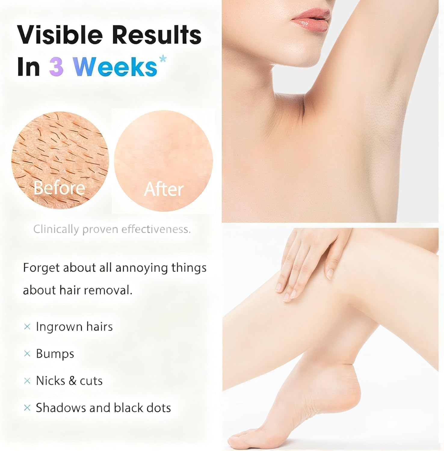 IPL Laser Hair Removal Device Permanent Painless Remover Reduction in Hair Regrowth for Women and Man at Home Whole Body Armpits Back Legs Arms Face Bikini Line, Corded image number 1