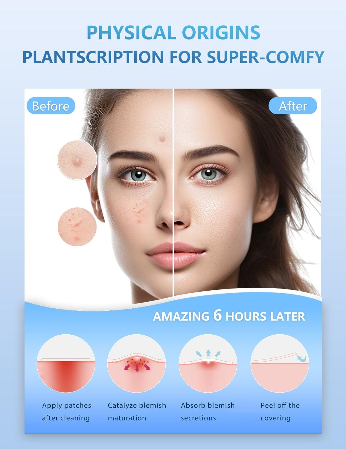 Pimple Patches for Face, 255Pcs 5Colors & 5Sizes(8,10,12,14,16Mm) Hydrocolloid Acne Patches Precise Matches Different Sizes, Cute Star Spot Stickers, Tea Tree Salicylic Acid Centella, Zits Absorbing