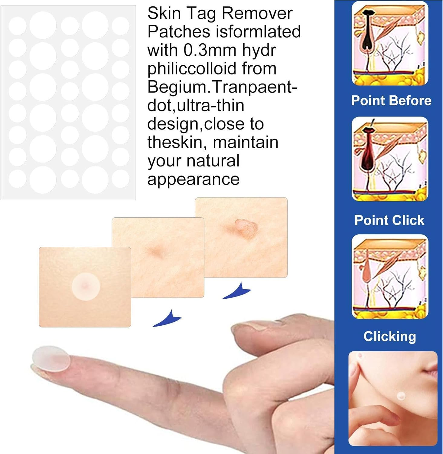 Skin Tag Remover Tools, Wart Remover Pen, Skin Tags Device for Small/Large Tags(4-9Mm), with Removes Cone-Shaped, Cleansing Pads, Patches, Instruction Manual image number 5