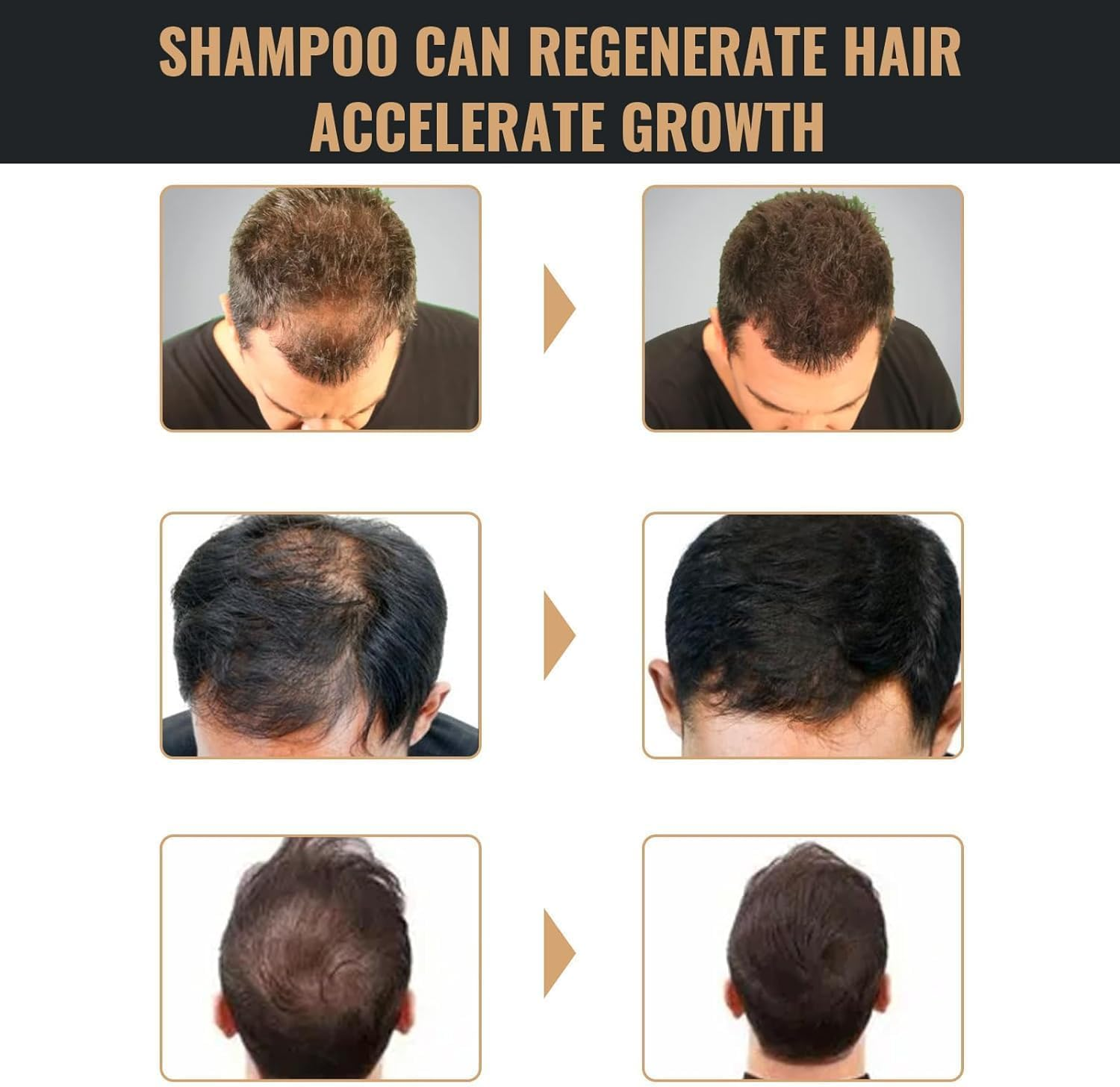 Spartan Root Activator Shampoo, Spartan Hair Shampoo, Spartan Hair Growth Shampoo, Spartan Shampoo (2 PCS)