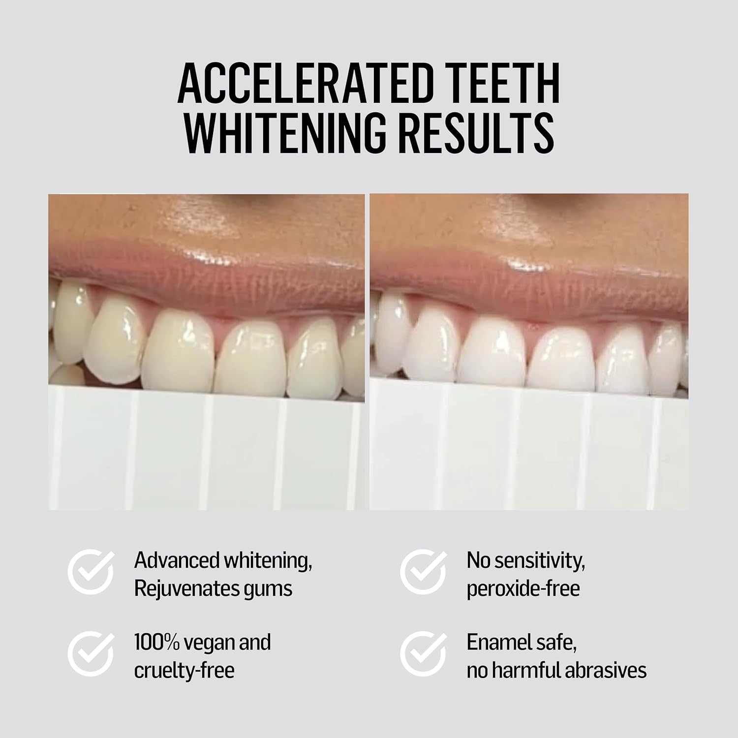 Polished London Teeth Whitening Kit with LED Dual Light ? PAP Pro Formula, Peroxide-Free, Vegan, No Sensitivity, up to 10 Shades Whiter, Enamel Safe, Dentist Approved, Home Use