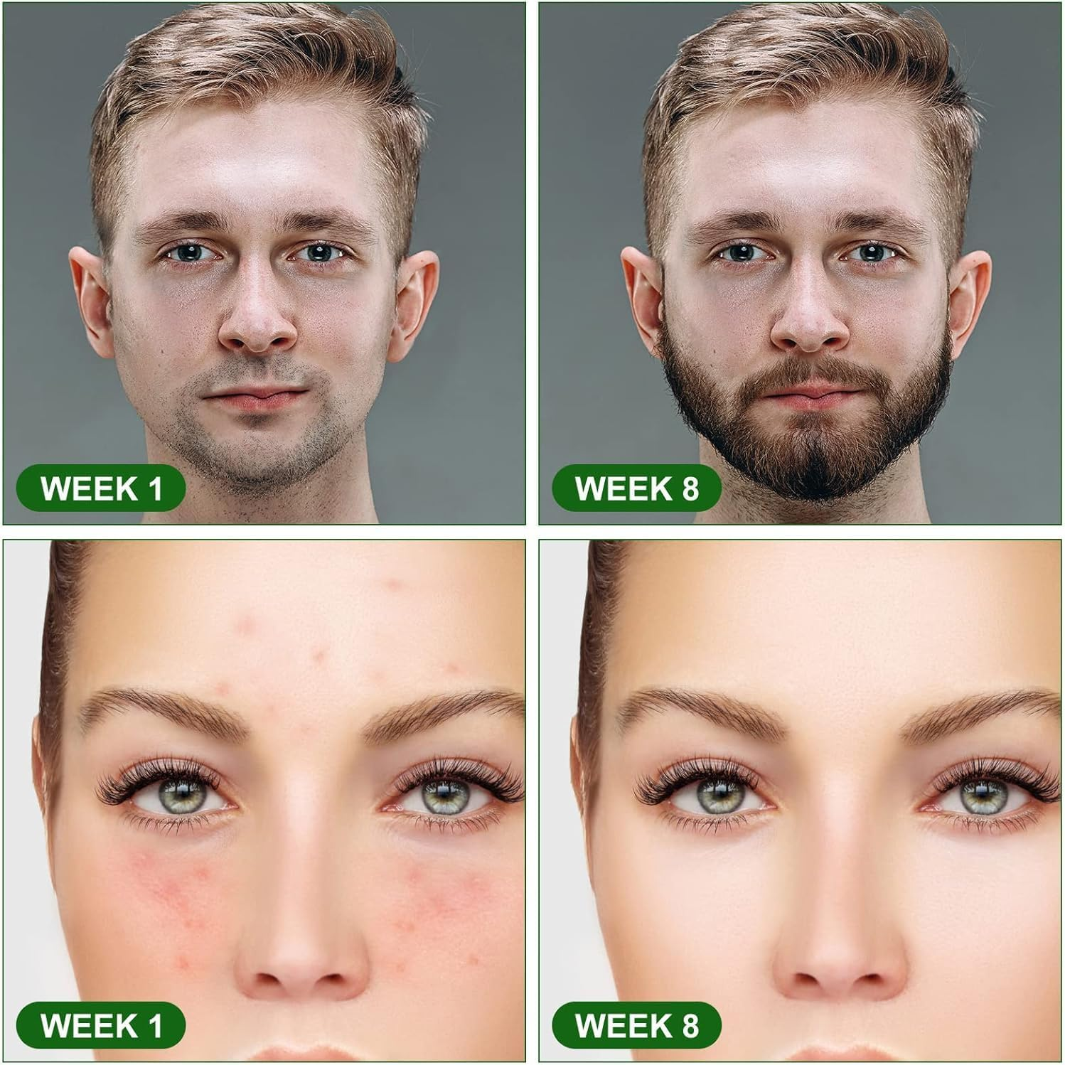 Derma Roller for Hair & Beard Growth, 0.75Mm Microneedle Roller for Skin Care, Fine Lines, and Pore Reduction, Stimulate Hair Growth, Use for Men and Women Haheihei image number 2