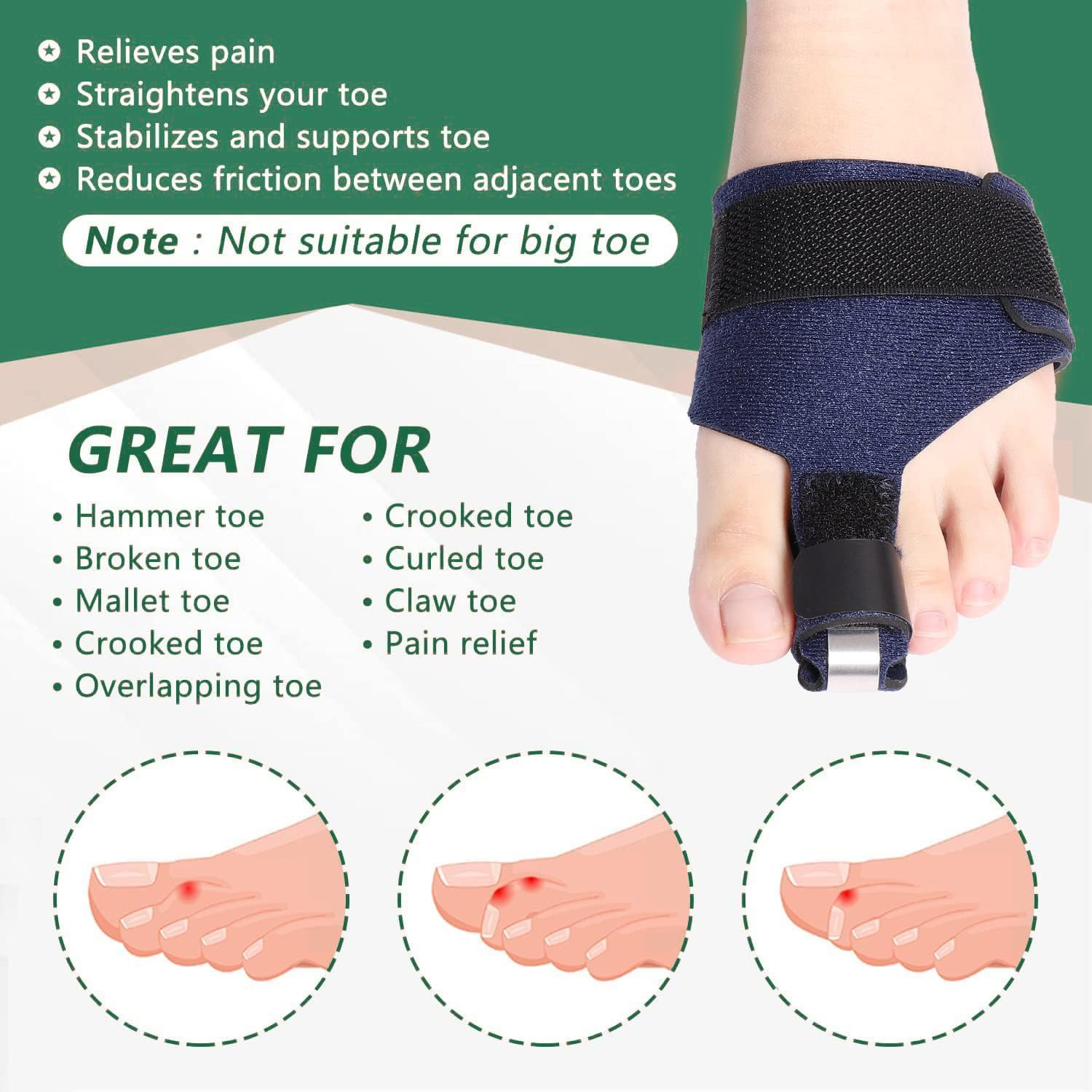 Toe Straightener, Hammer Toe Corrector for Women and Men, Toe Splint for Broken Toe, Claw Toetoe Brace for Second Toe to Pinky Toe Support (Blue, One Size) image number 4