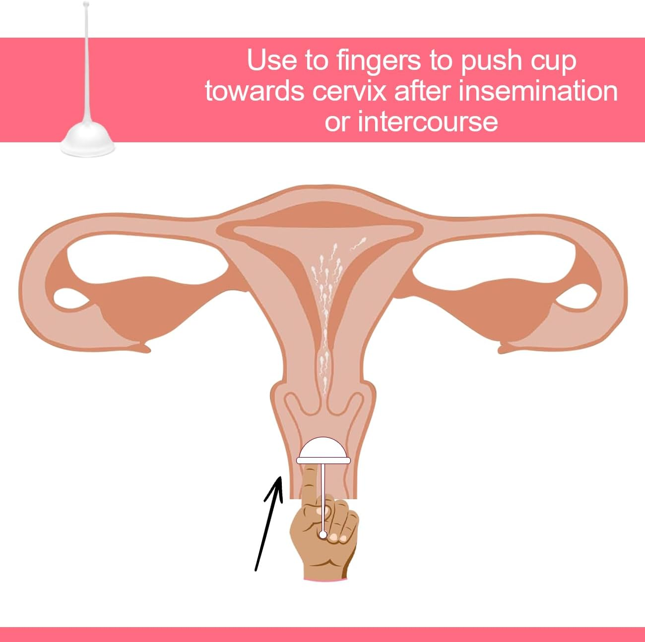 Cervix Sperm Cup,Transparent Color image number 1