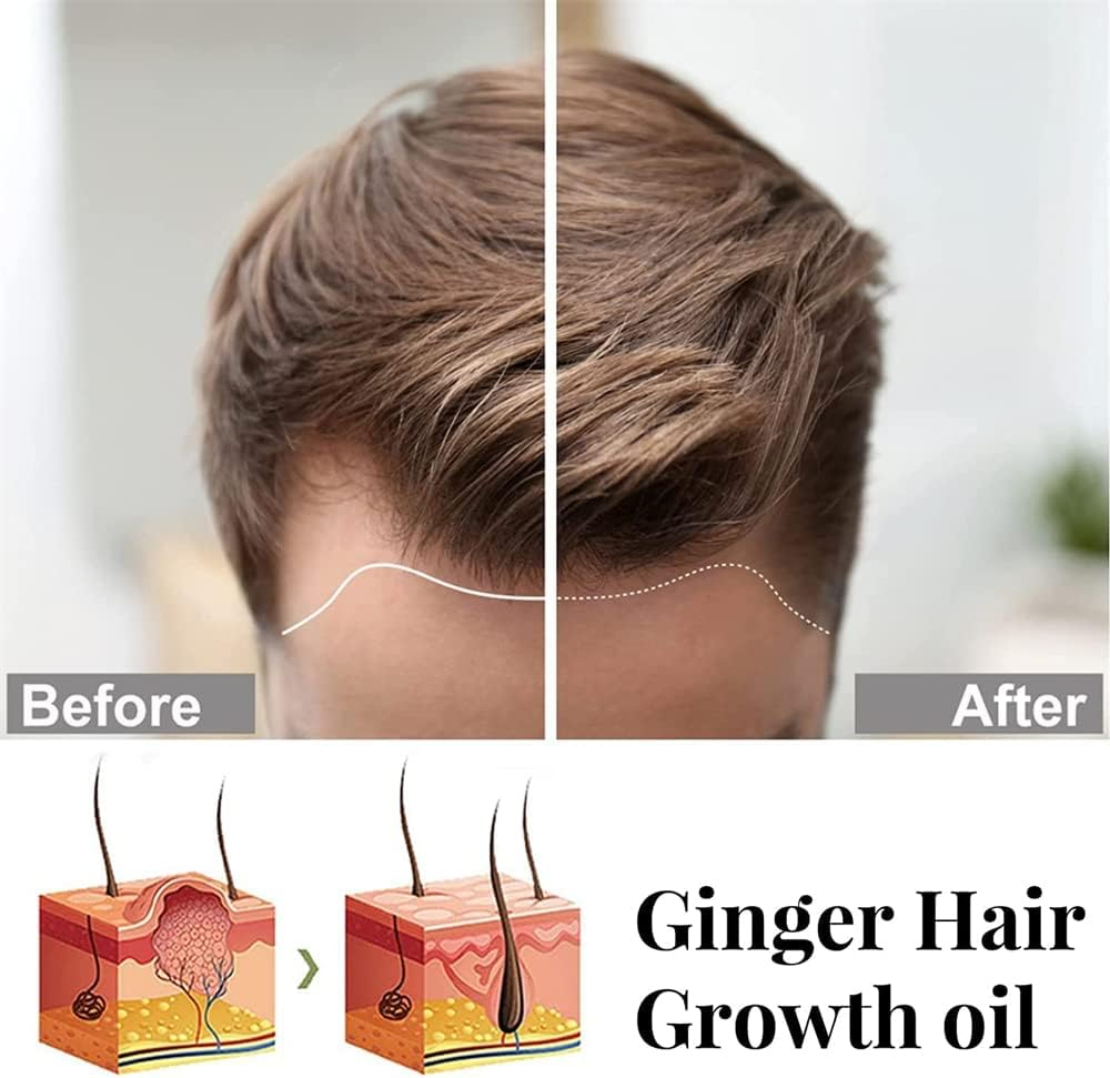 2Pcs Suna Plant Extract Hair Growth Oil,Ginger Germinal Essential Oil Hair Growth Hair Loss Treatment Hair Care Hair Growth Serum for Men & Women