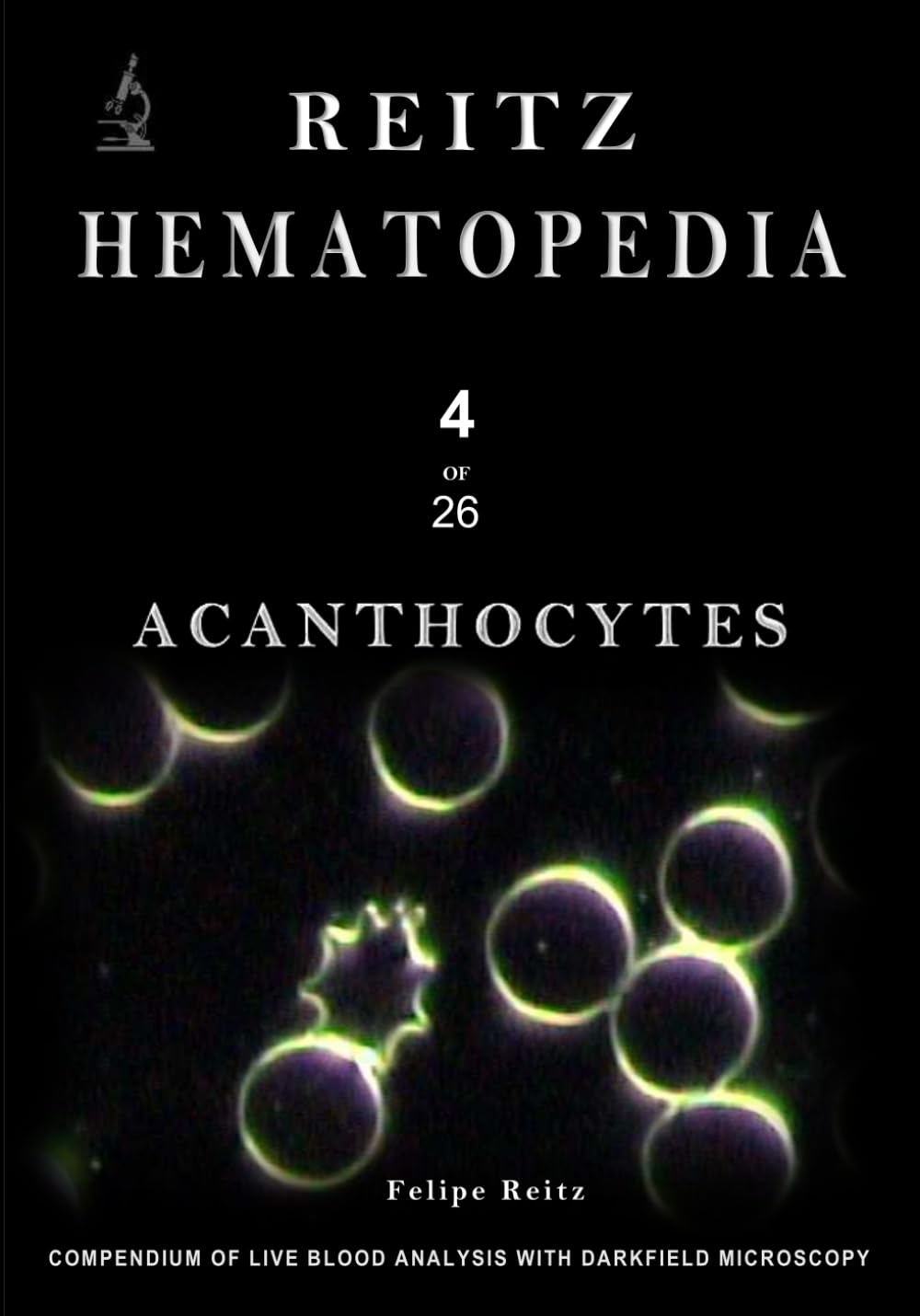 Acanthocytes: Compendium of Live Blood Analysis with Darkfield Microscopy