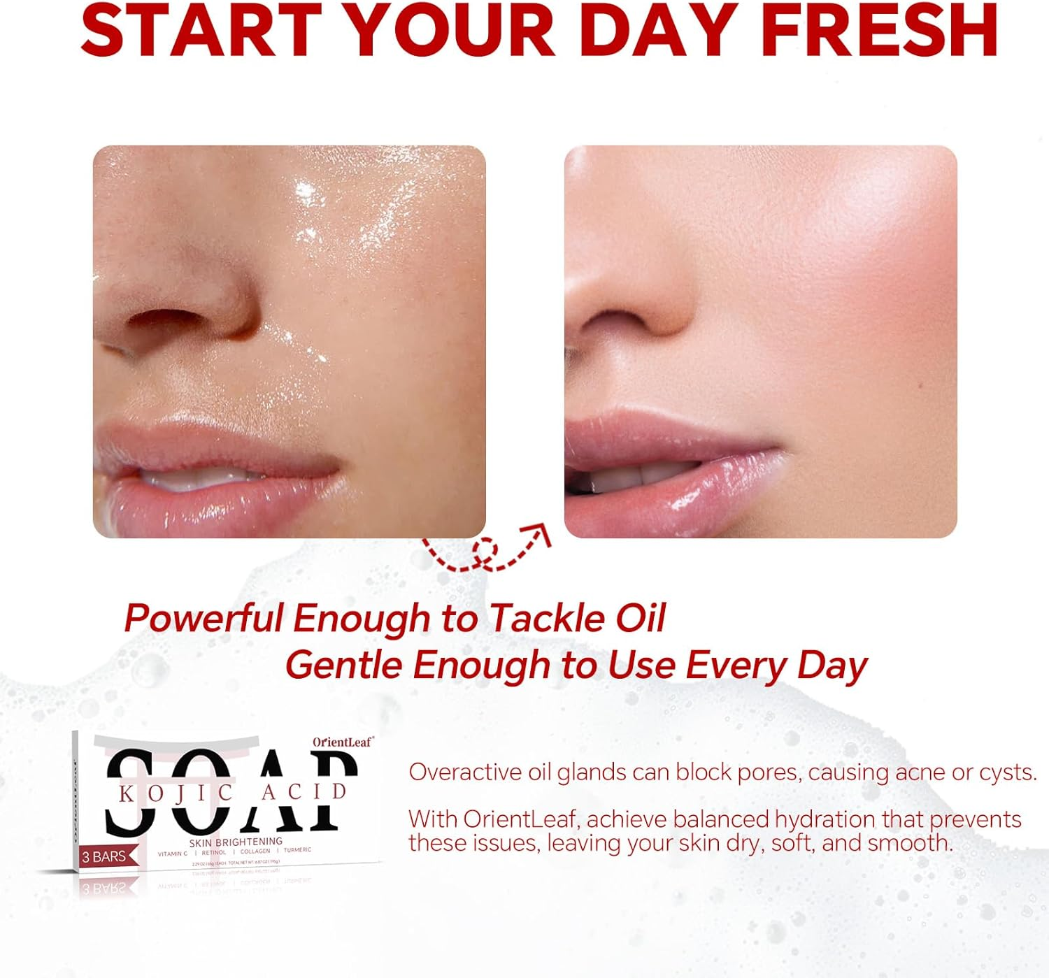 ORIENTLEAF Kojic Acid Soap, Turmeric Soap Bar, Fresh Citurs Scent, Gentle for Face and Body with Vitamin C, Shea Butter, Retinol, Olive Oil, Collagen (3 PACK) image number 1