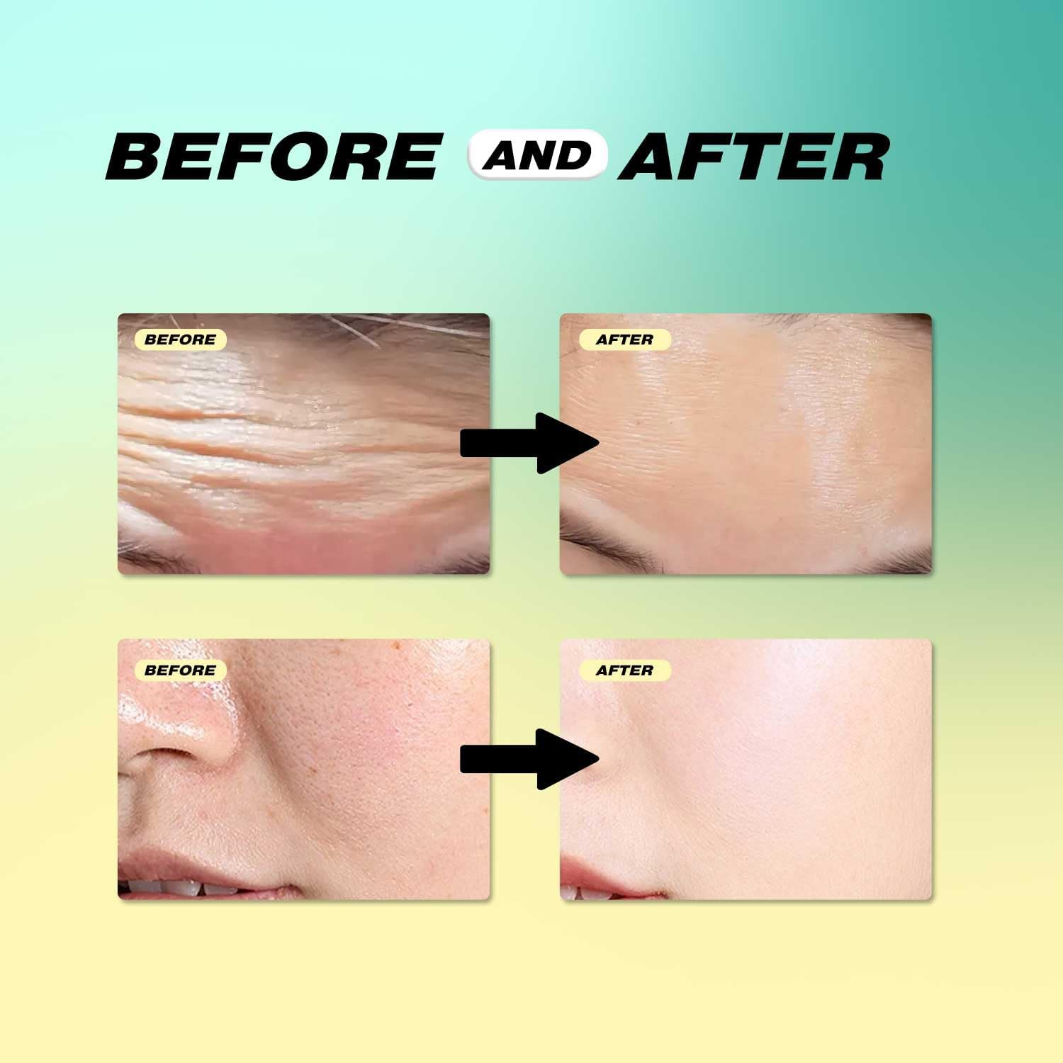 12 Pack Forehead Wrinkle Patches,Collagen Wrinkle Patche,Apply to the Skin between the Foreheads,Reduce Forehead Wrinkles,Deep Crease Care for Sensitive Skin,Moisturize Facial Care image number 2