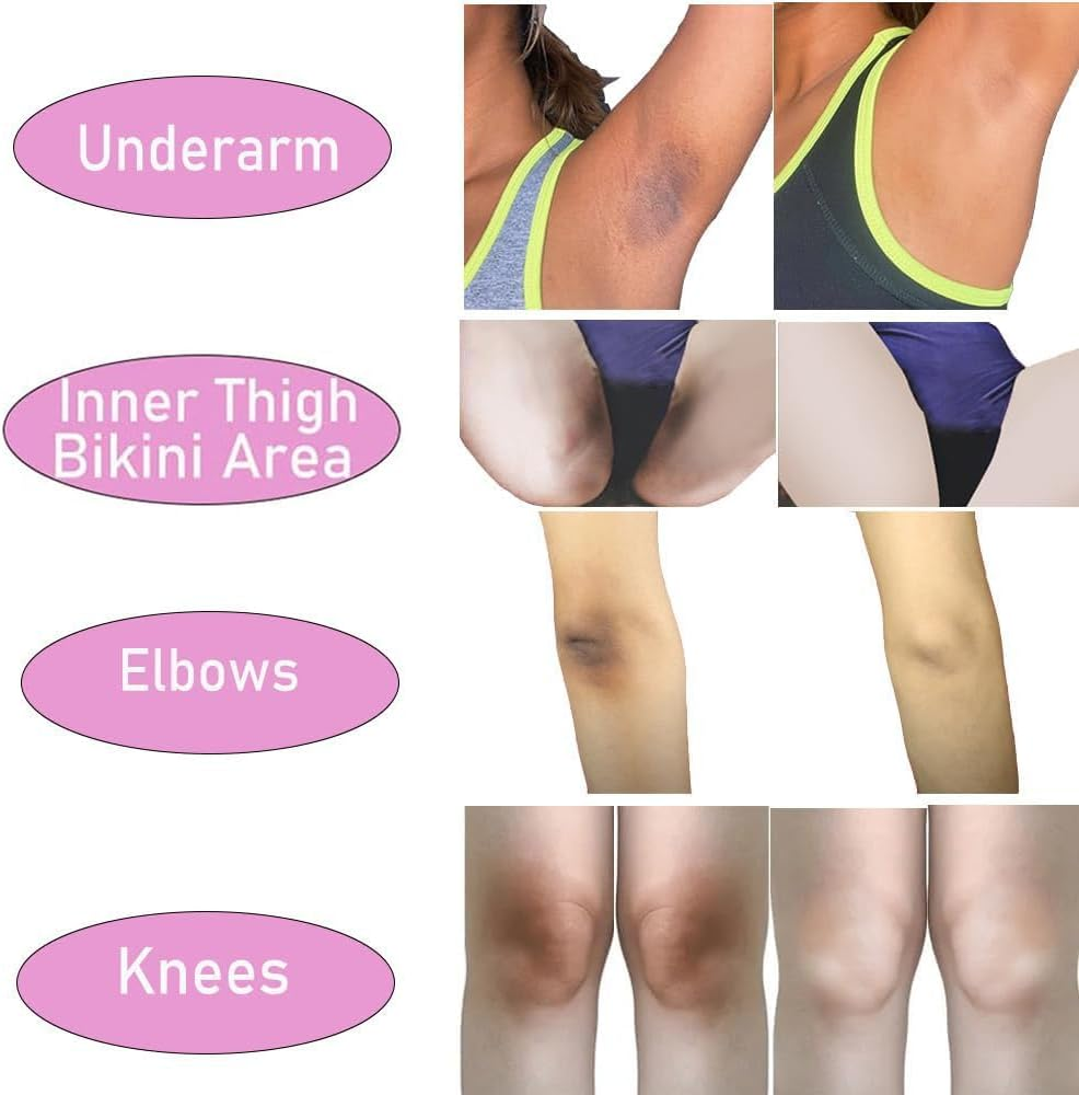 Ivanka Pigmentation Soap Original Kojic Care Glutathione Boobs Pigmentation Dark Spots & Sun Damage Skin Whitening Brightening Lightening Men Women image number 3