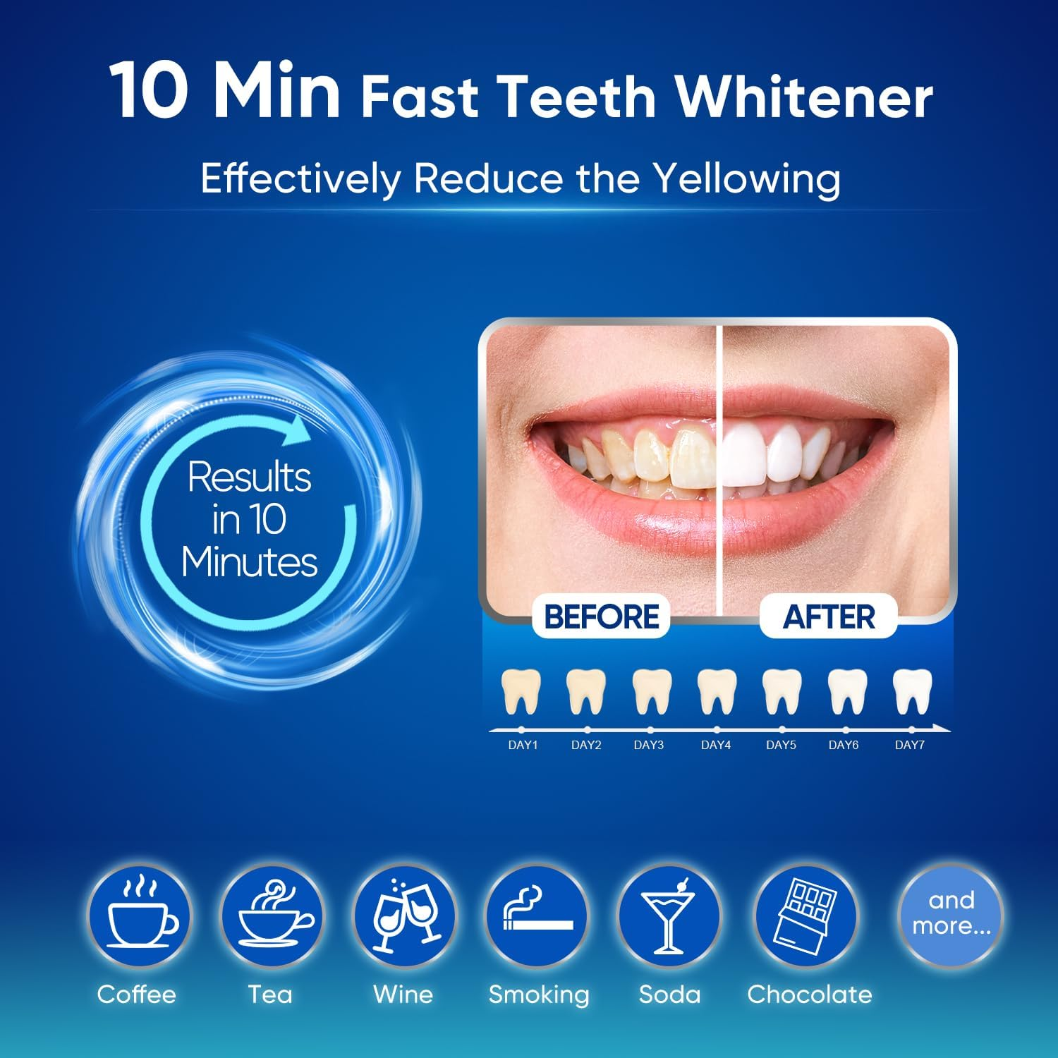 Mysmile 30 Treatments Teeth Whitening Kit with LED Light for Sensitive Teeth, 3Pcs Enamel Safe Teeth Whitening Gel,10 Fast Fast Remove 20 Years of Stains, Whitening Tooth Care Oral Bright Smile Alternative Teeth Whitening Strips image number 4