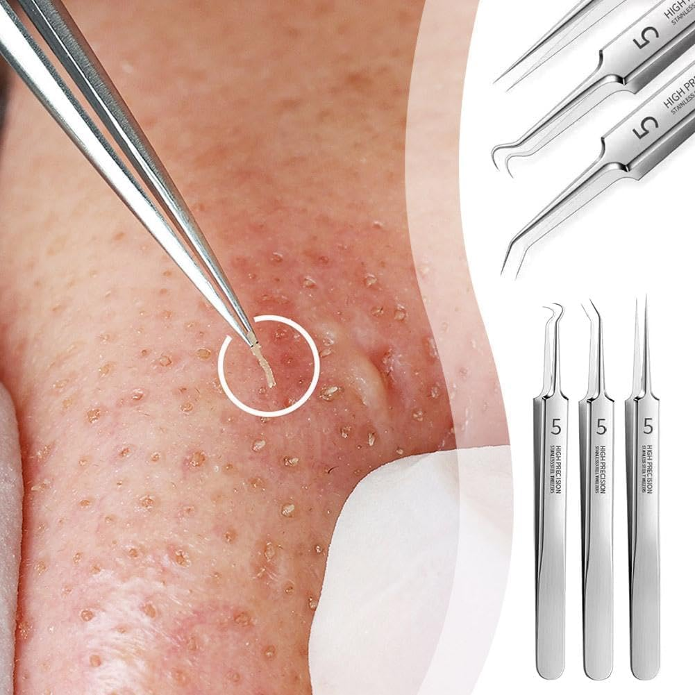 3Pcs Professional Blackhead Tweezer Professional Facial Blackhead Remover Tweezers Precision Extractor Acne Removal Kit Pimple Popper Tool with Storage Box