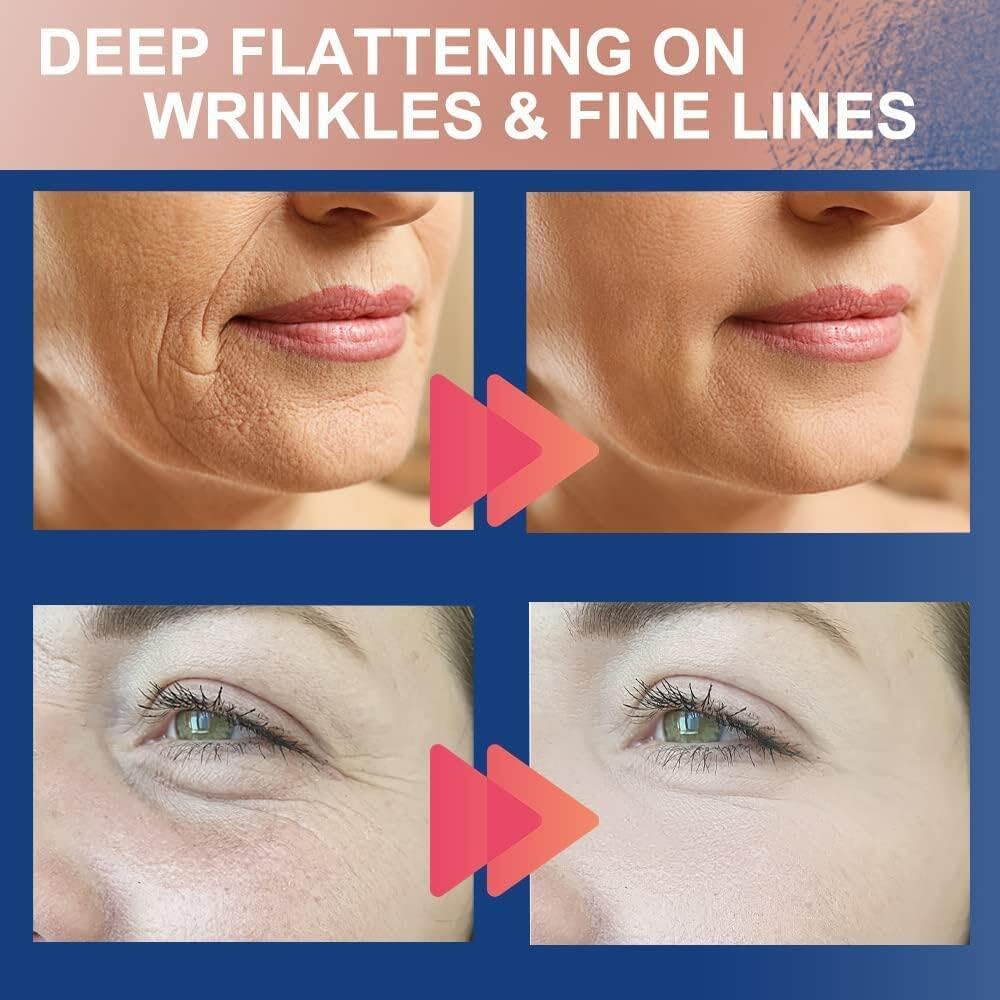 Dolemay Wrinkles Face Patches,2 PCS Face Tape 2.5Cm*5M Neck Forehead Eye Double Chin Lift V Shape Refill Tapes Multifunctional High Elasticity Wrinkle Patches Kinesiology Tape Face Skin Lifting Tape image number 5