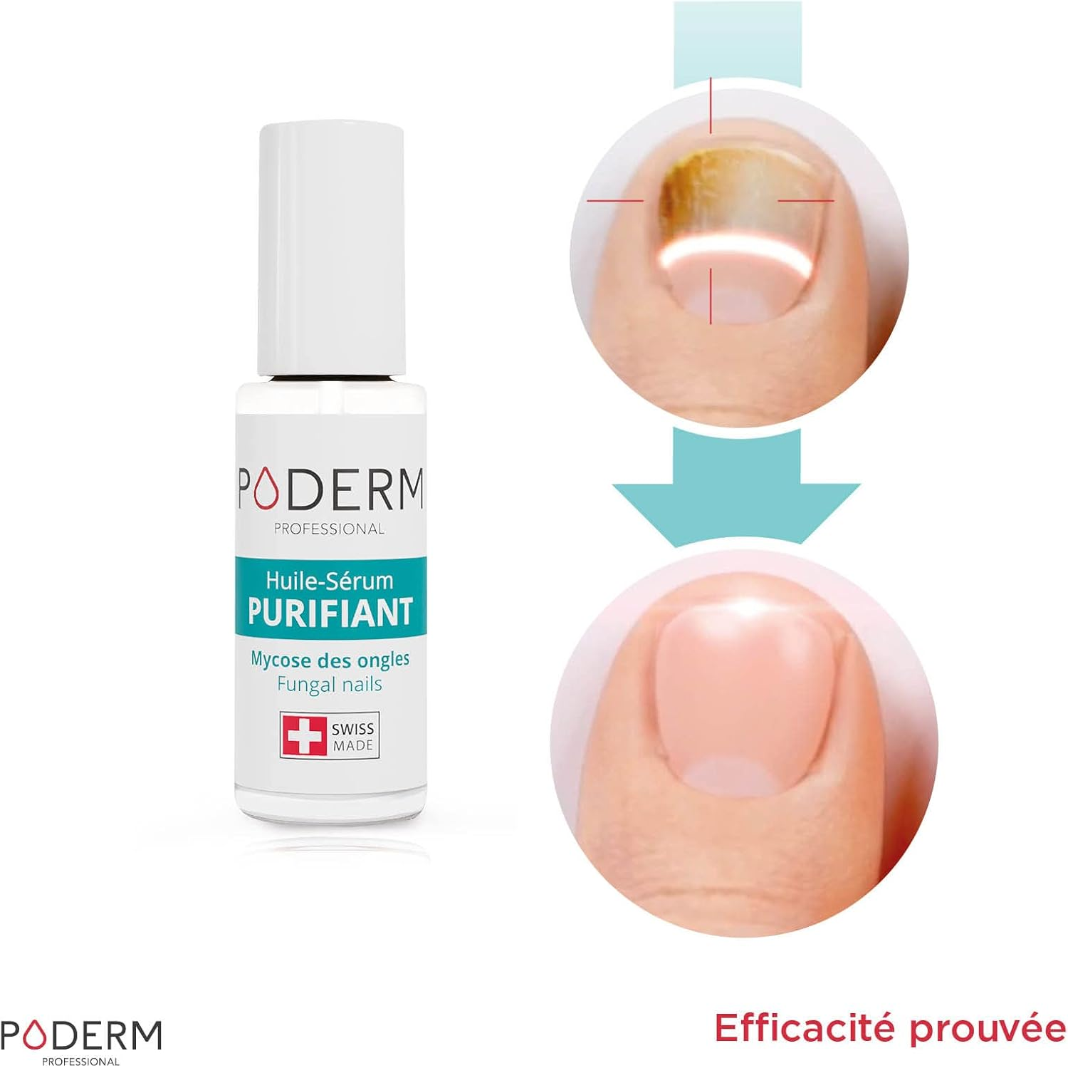 PODERM - 2X PACK - 2-In-1 FUNGAL INFECTION NAIL TREATMENT| with Exceptional Plants with Powerful Anti-Fungal Restorative Properties | Professional Foot/Hand Treatment | Quick & Easy | Swiss Made image number 4