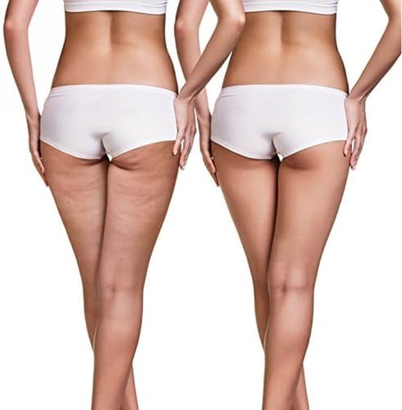 TESMED Cell anti Cellulite Massage Roller with Handle - Green image number 6