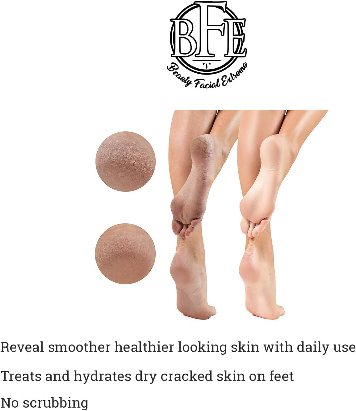 Exfoliating Body Lotion &ndash; 12% Lactic Acid Body Lotion. Provides Immediate Moisture & Gentle Exfoliation to Treat Symptoms Associated with Keratosis Pilaris & Dry Skin Conditions.