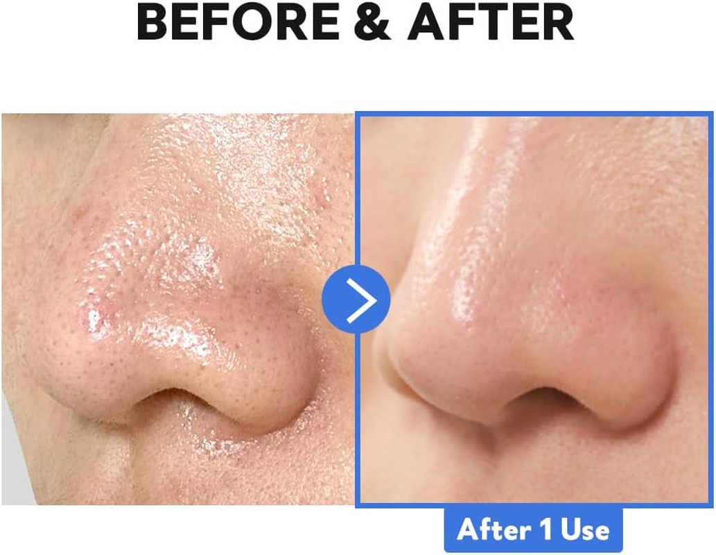 TIRTIR Hydro Boost Enzyme Cleansing Balm image number 5