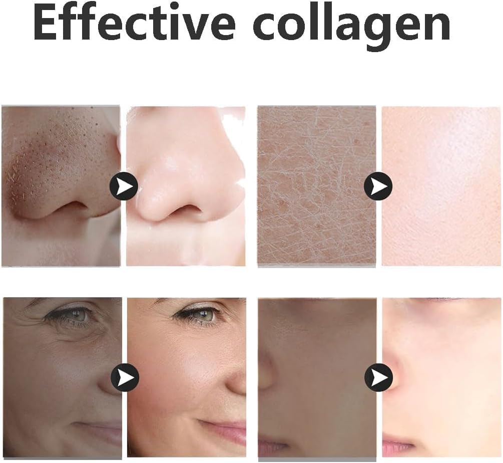 CEELGY 4Pcs Bio Collagen Mask,Hydrating Overnight Hydrogel Mask for All Skin Types, Collagen Night Wrapping Mask, Deep Moisturizing, Pore Minimizing, Firming. 34G X 4Ea image number 3