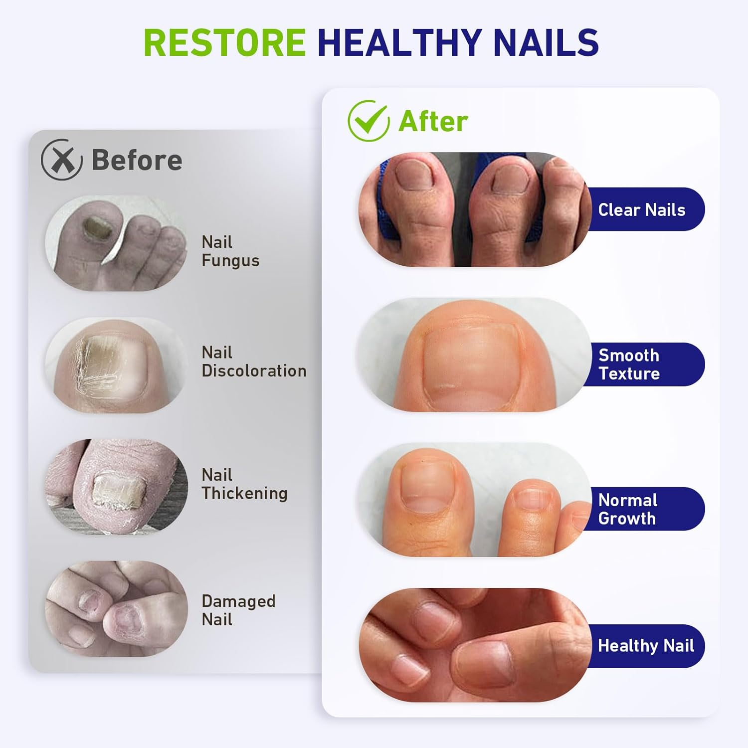 Ikeener Nail Fungus Laser Treatment Device, Large Size Fungal Nail Treatment Device with 15*470Nm Blue Light and 42*650Nm Red Light, Natural Solution for Damage, Broken, Cracked & Discolored Nails image number 6