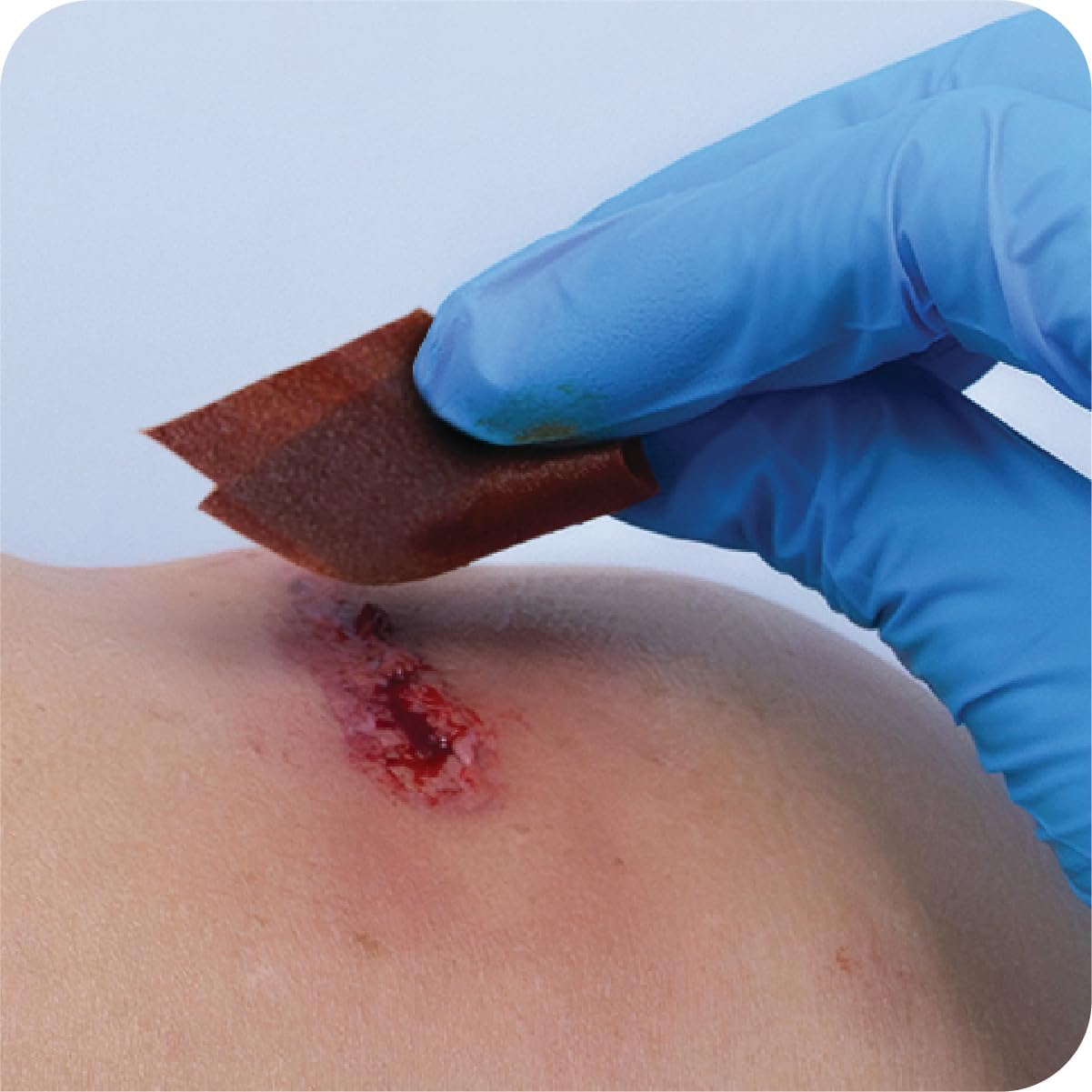 AEROWIPE 10% Povidone Iodine Swabs, Antiseptic Wipes for Pre‑Procedure Skin Cleansing, Alcohol Free, Individually Wrapped 2 Ply Pads for Consistent Coverage, 60 Mm X 33 Mm, Box of 100 image number 1