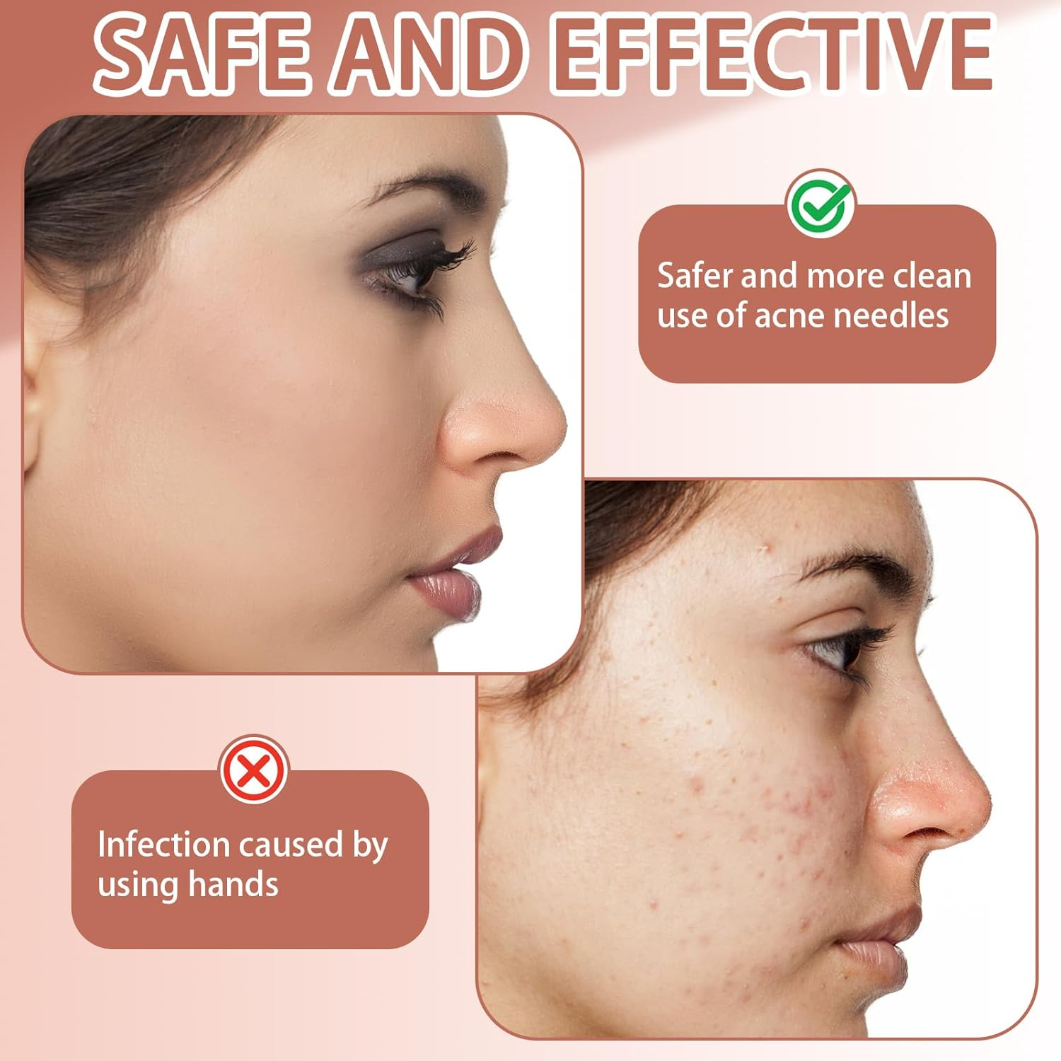 Lasuroa 7Pcs Pimple Popper Tool Kit, Blackhead Remover Tool Stainless Steel Comedone Extractor Blackhead Tweezers for Face Nose Cleaning