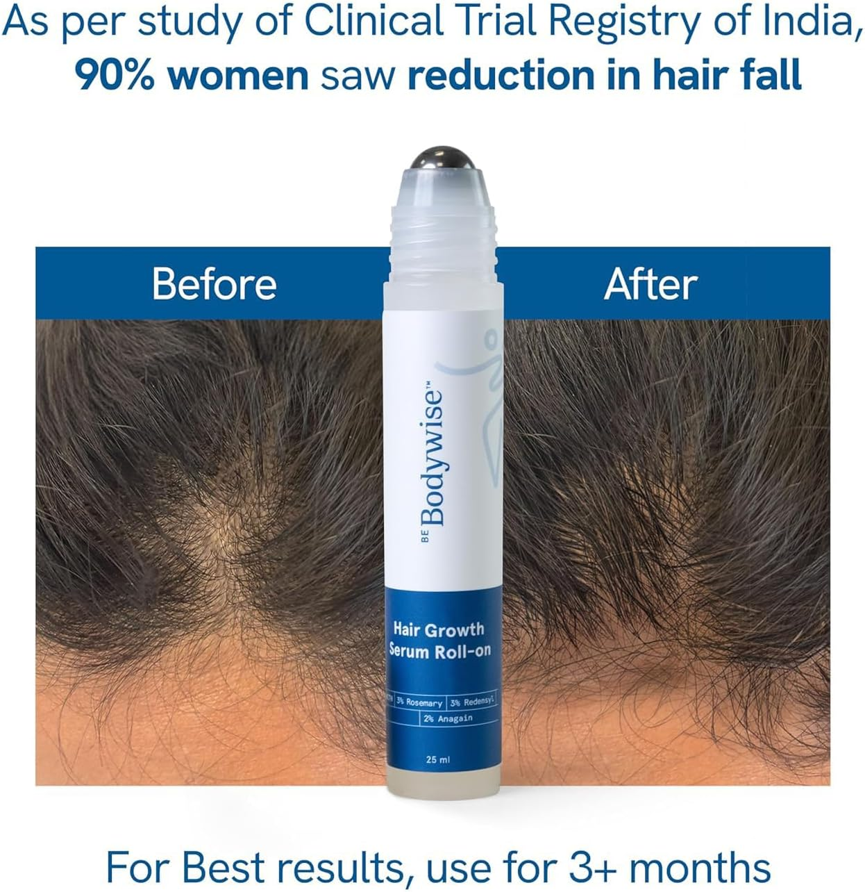Be Bodywise 3% Rosemary Hair Serum (Roll On) 50Ml | 3% Redensyl, 2% Aminexil & 2% Anagain | Thicker & Stronger Hair Growth | Prevents Hair Fall & Stimulates Hair Follicles | Pack of 2 image number 3