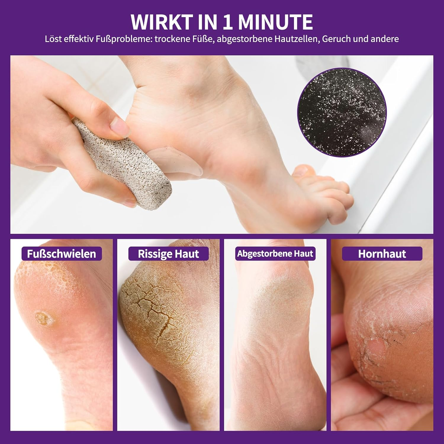 Nbc Beautilab Callus Remover, 25 Pieces Callus Remover with Pumice Stone Individually Wrapped Use with Pumice Stone for Faster Removal of Calluses - Lavender Fragrance