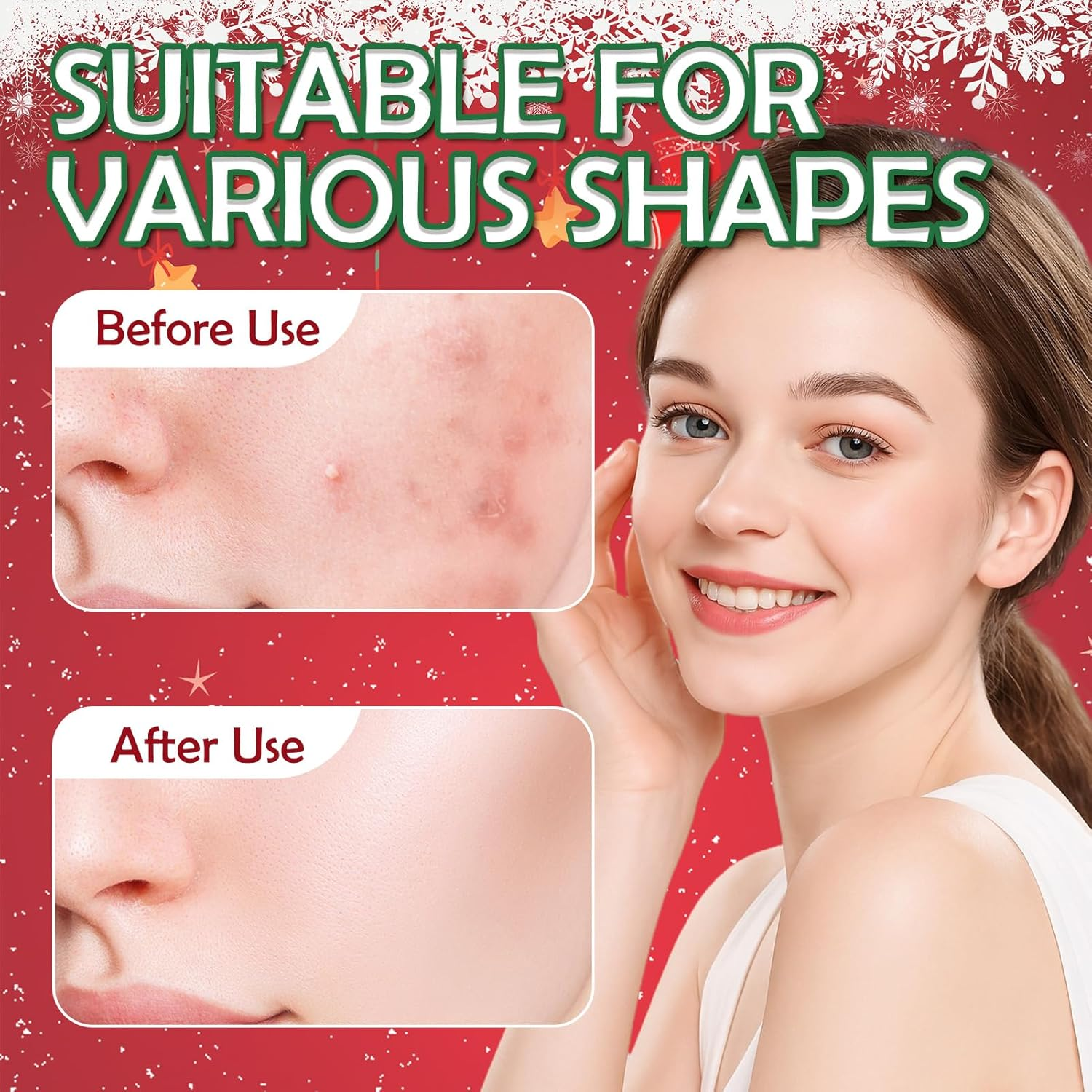 Pack of 12 Pimple Patches, Christmas Pimple Patches, anti Pimple Patches, Acne Patches, Day and Night Acne Patches, Waterproof, Breathable, Various Shapes