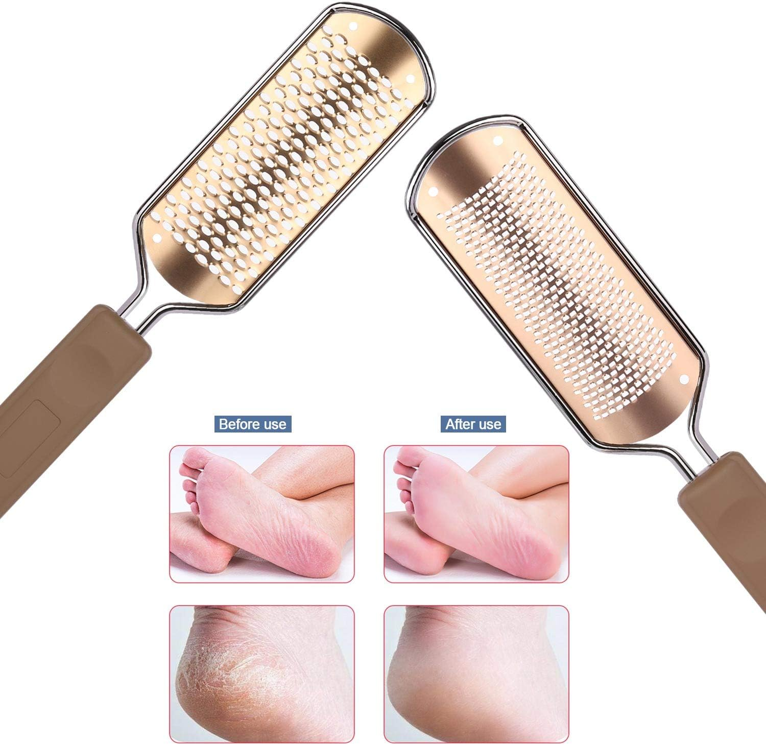 2 Pack Foot File & Rasp Callus Remover - Stainless Steel Coarse & Fine Scraper for Dry/Wet Feet, Professional Dead Skin Scrubber & Cracked Heel Care image number 1