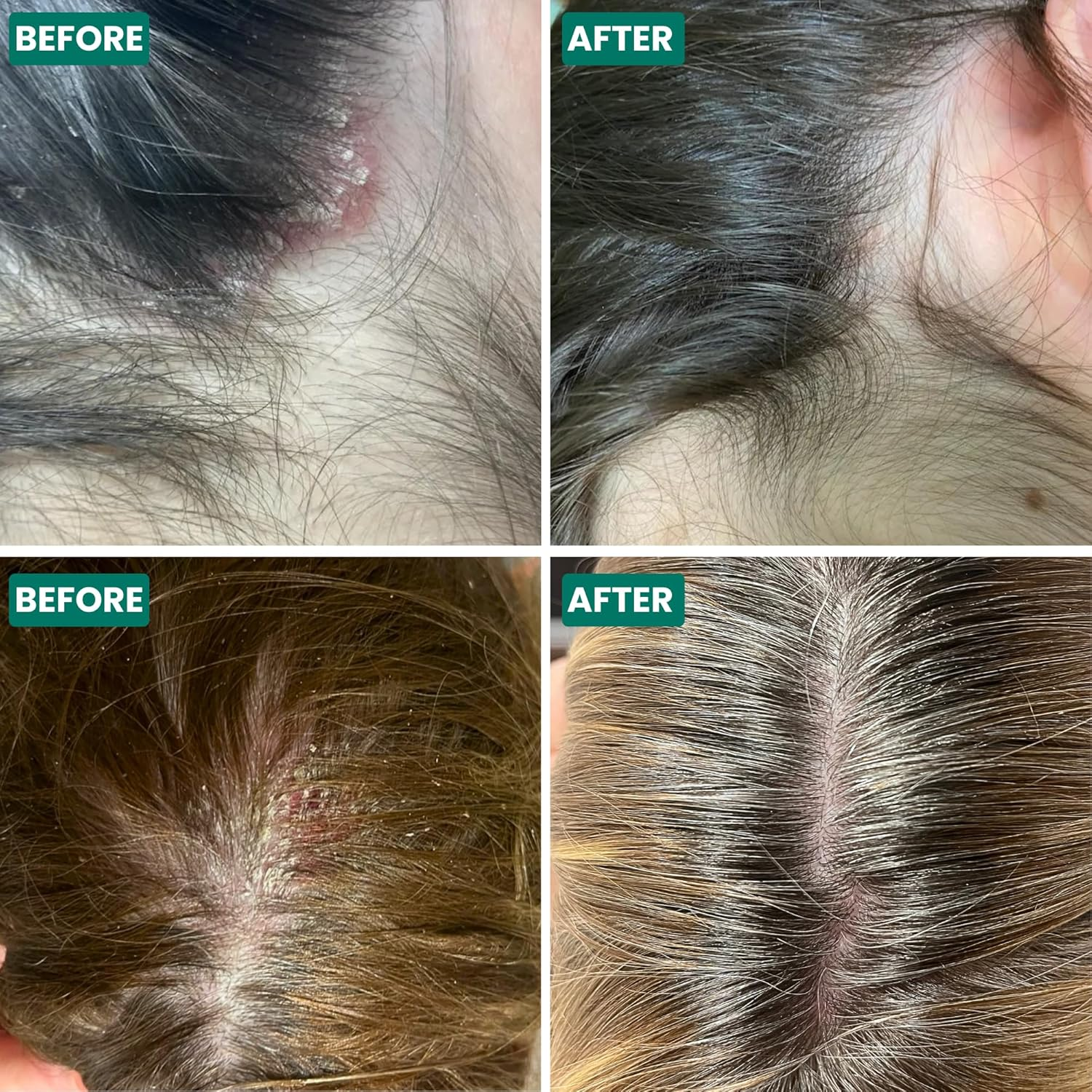 Grahams Natural Scalp Relief Cream - Seborrheic Dermatitis, Dandruff Scalp Treatment - Moisturises Dry, Itchy & Flaky Scalps - Manuka Honey, Calendula, Jojoba Seed Oil (1 X 60G) image number 1