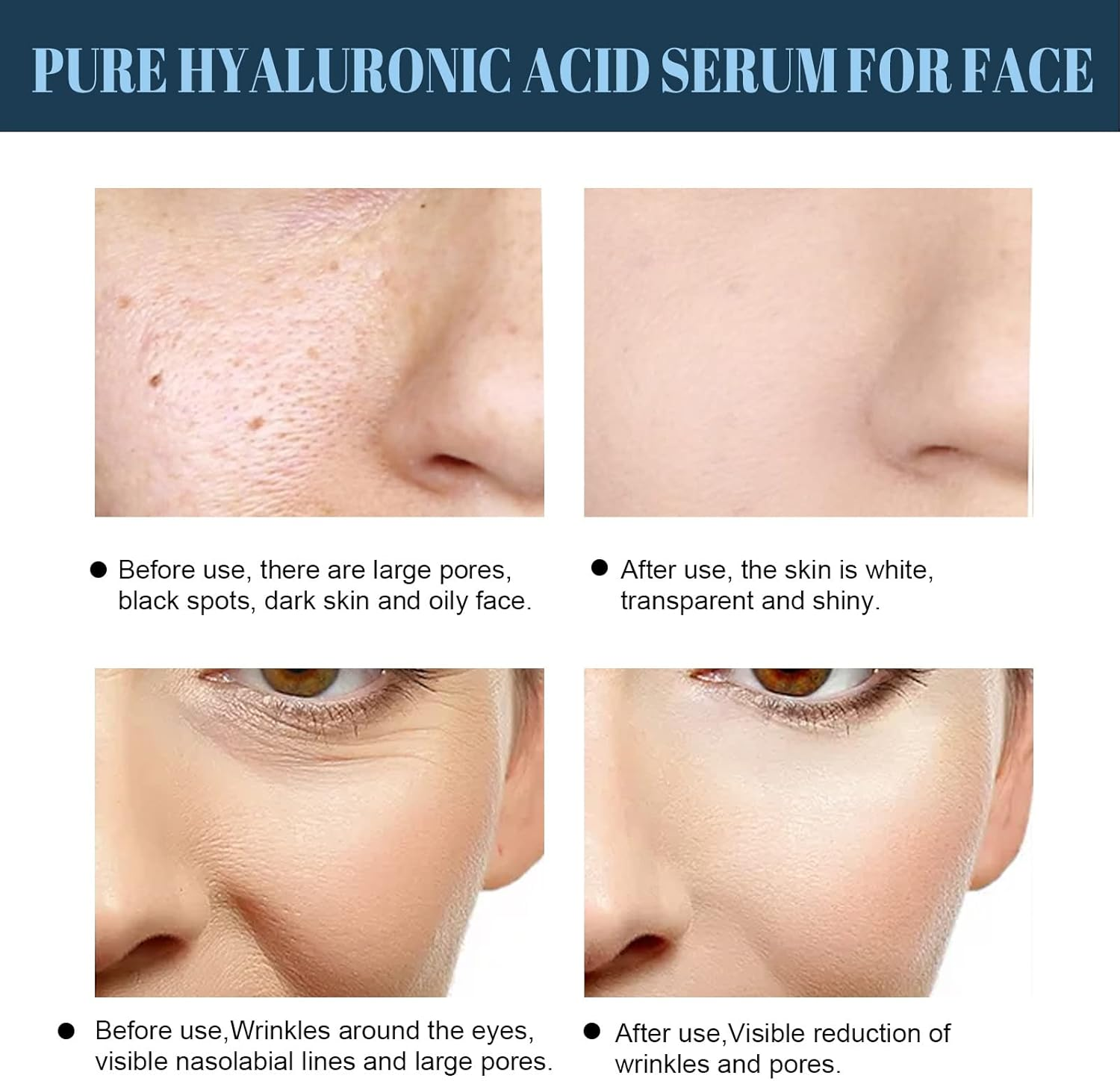 Protein Lift Line Skin -Wrinkle V-Face Firming Lifting Sagging Facial Contour ALKOY