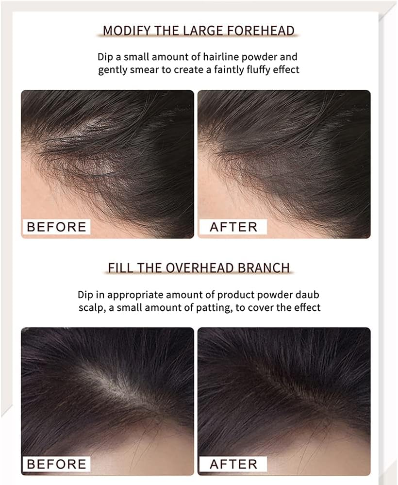 Hairline Powder, Instantly Hairline Shadow, Root Touch up Powder, Hair Powder for Thinning Hair, Root Cover Up, Hair Toppers for Women & Men, Windproof&Sweatproof,Grey Hair Cover up (Dark Brown) image number 1