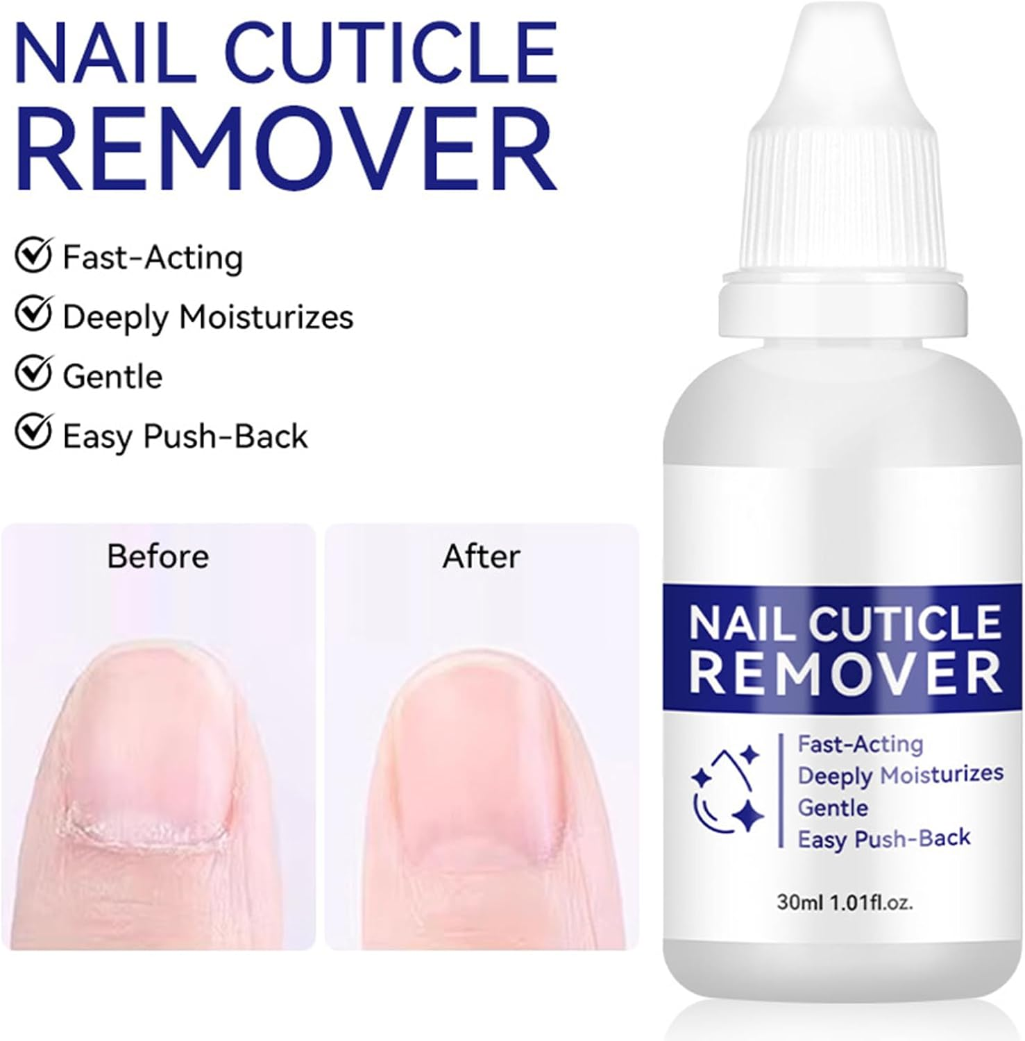 Cuticle Remover, Hydrating Pedicure Supplies, 30Ml Moisturizing Cuticle Softener Gel, for Dead Skin Dry Damaged Hangnails Hand Foot Polish Prep Beauty Routine Daily Salon Home image number 5