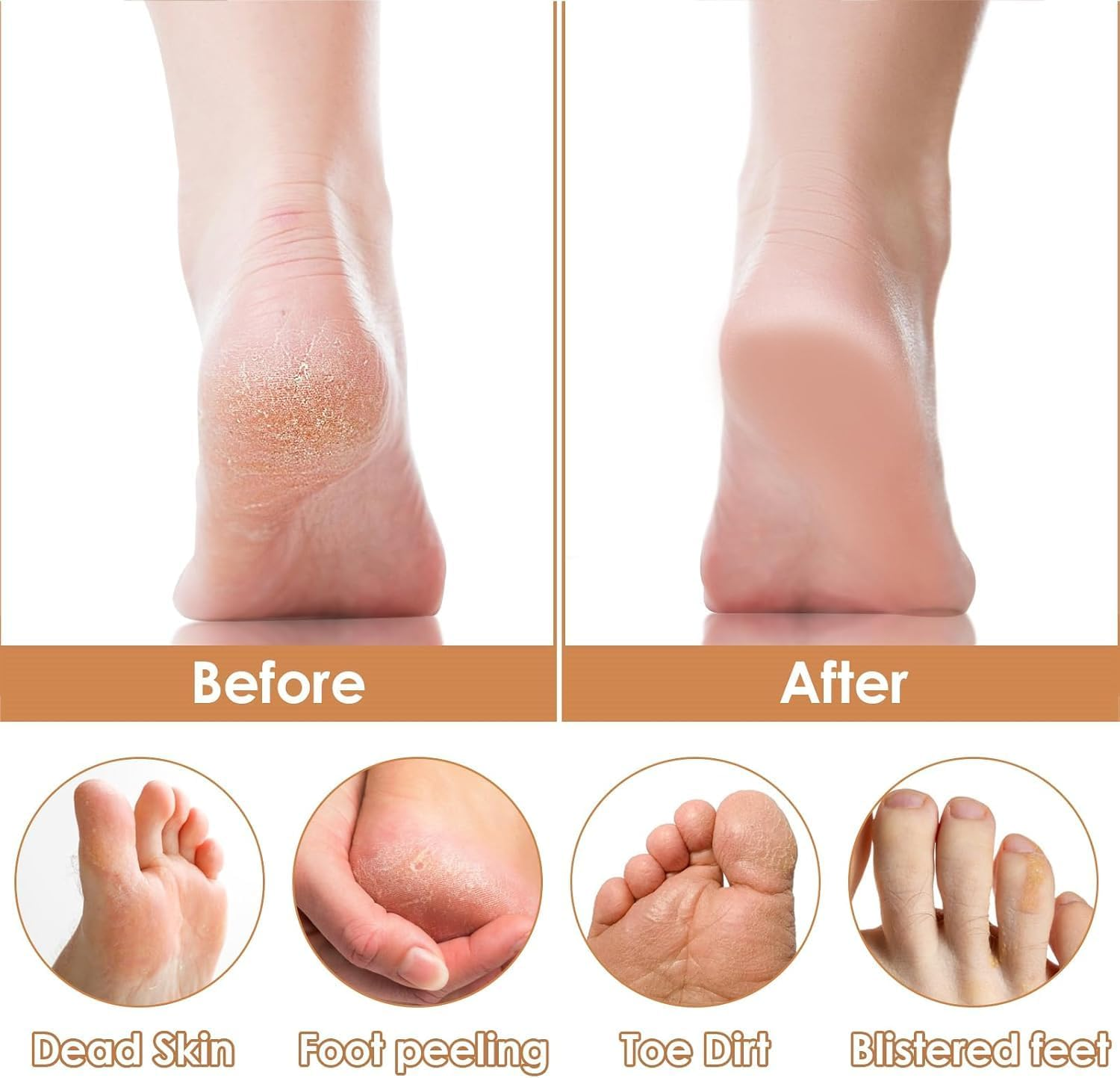 Father'S Day Ideal Gifts Foot Rasp Files&Nail Files Set Wooden Double-Sided Foot File with Bamboo Nail Buffer &ndash; Callus Remover, Dead Skin Exfoliator for Home Pedicure and Nail Care image number 4