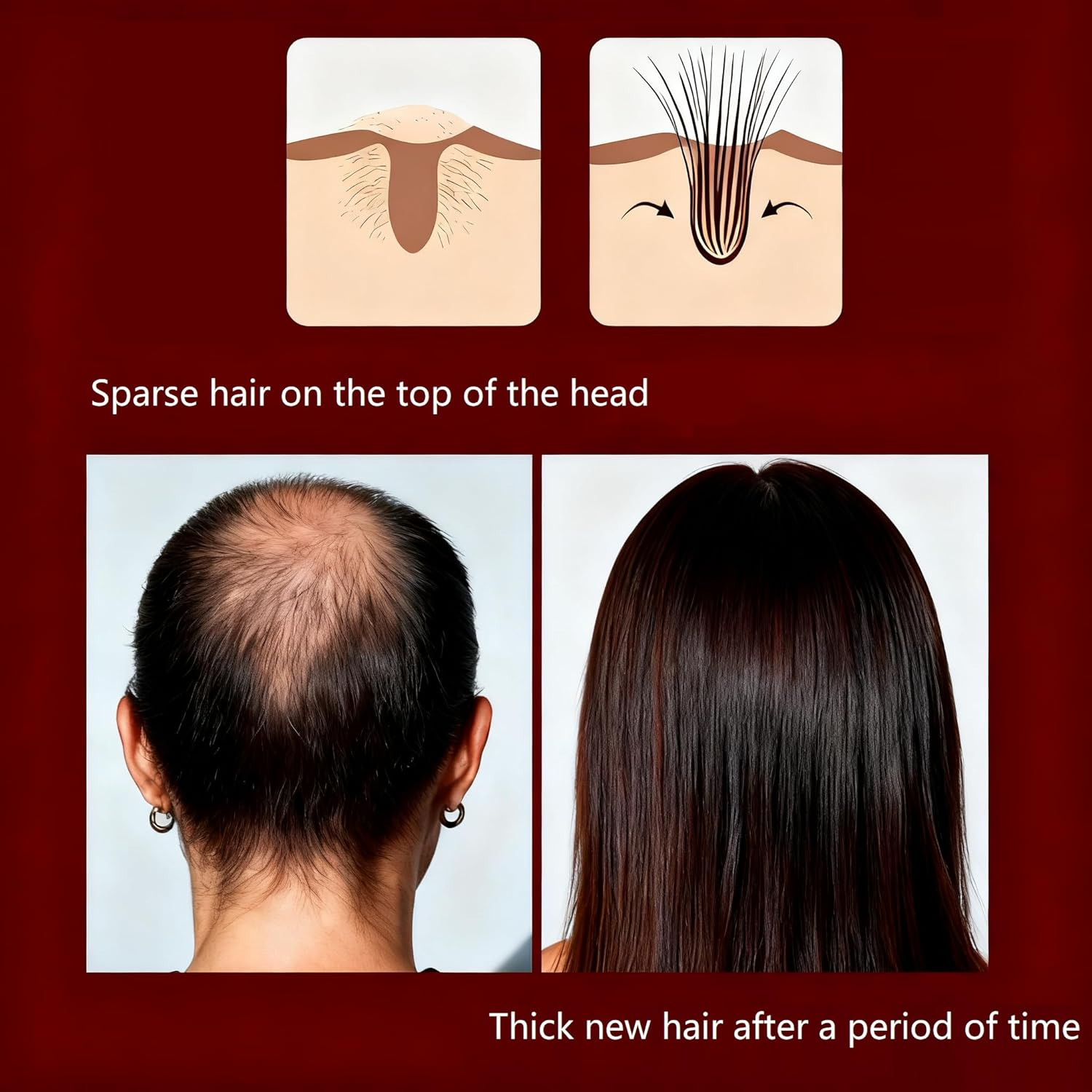 Red Onion Hair Growth Oil Onion Serum Spray: Fast-Absorbing, Non Greasy Formulated, Healthier Hair Enhances Shine, Reduces Hair Fall, Suitable for Dry, Thinning Curly Hair, Scalp for Thicker. (4PCS) image number 5