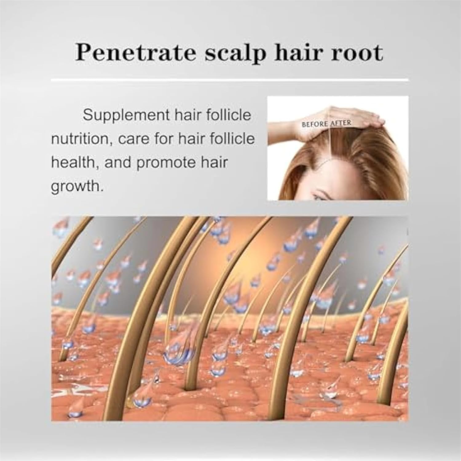 Alphainfuse Hair Regrowth System, Painless Microneedle Infusion Hairregrowth Solution, Scalp Nourishing Oil, Damage Repair, Loss Prevention, Enhances Thick Hair for Men Women (Typeb) image number 1