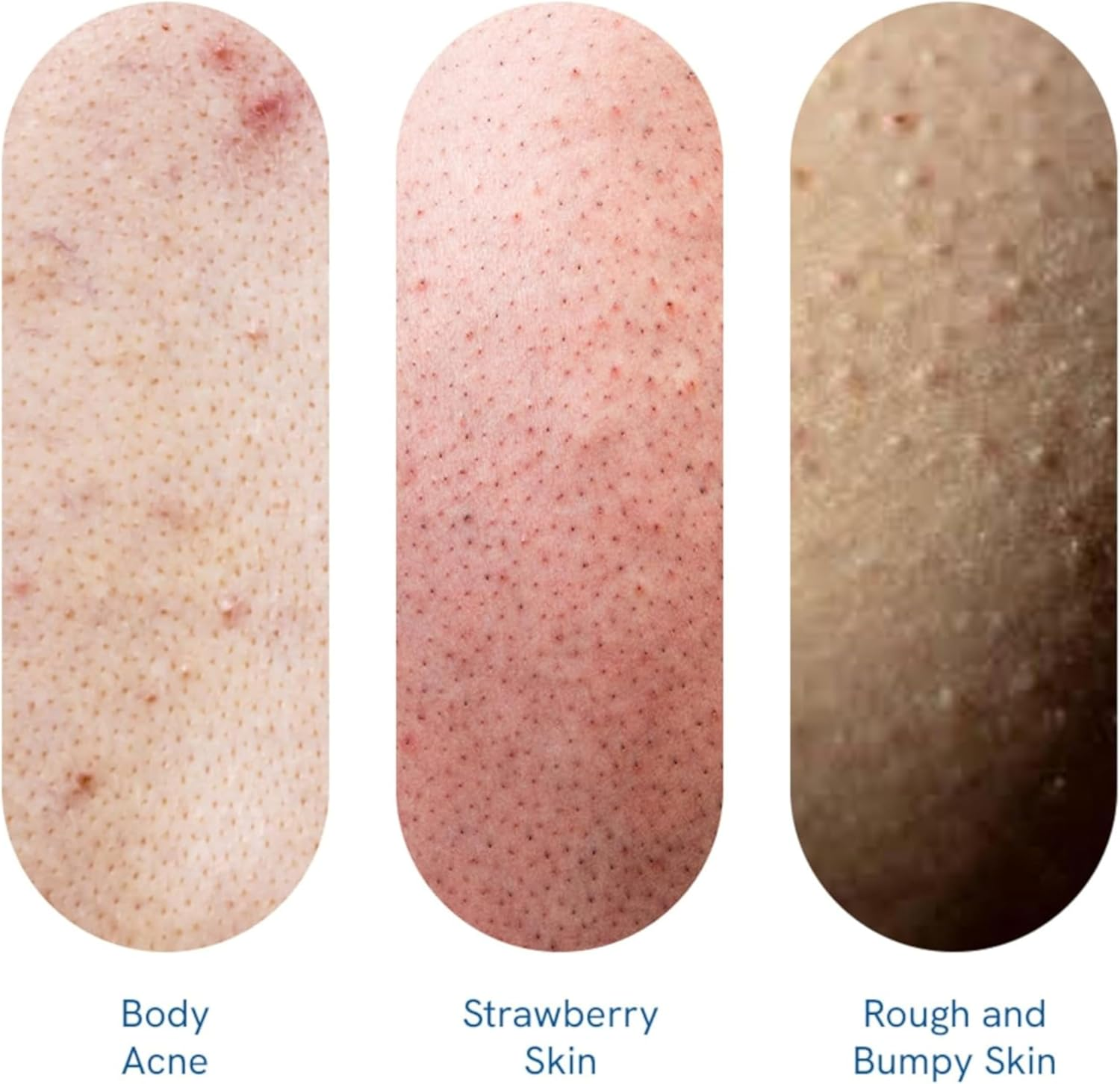 Be Bodywise 1% Salicylic Acid Body Wash 500Ml | Helps to Prevent Body Acne & Cleanse Skin | Paraben and SLS Free | Pack of 2 image number 5