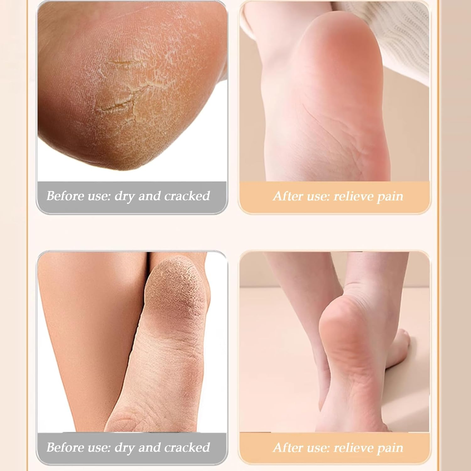 Qkbuza Women'S Foot Socks - Moisturizing Skin-Friendly Liquid Silicone Foot Socks,Ergonomic U-Shape Spa Cover for Cracked Heel Men Women - Pink Foot Mask image number 3