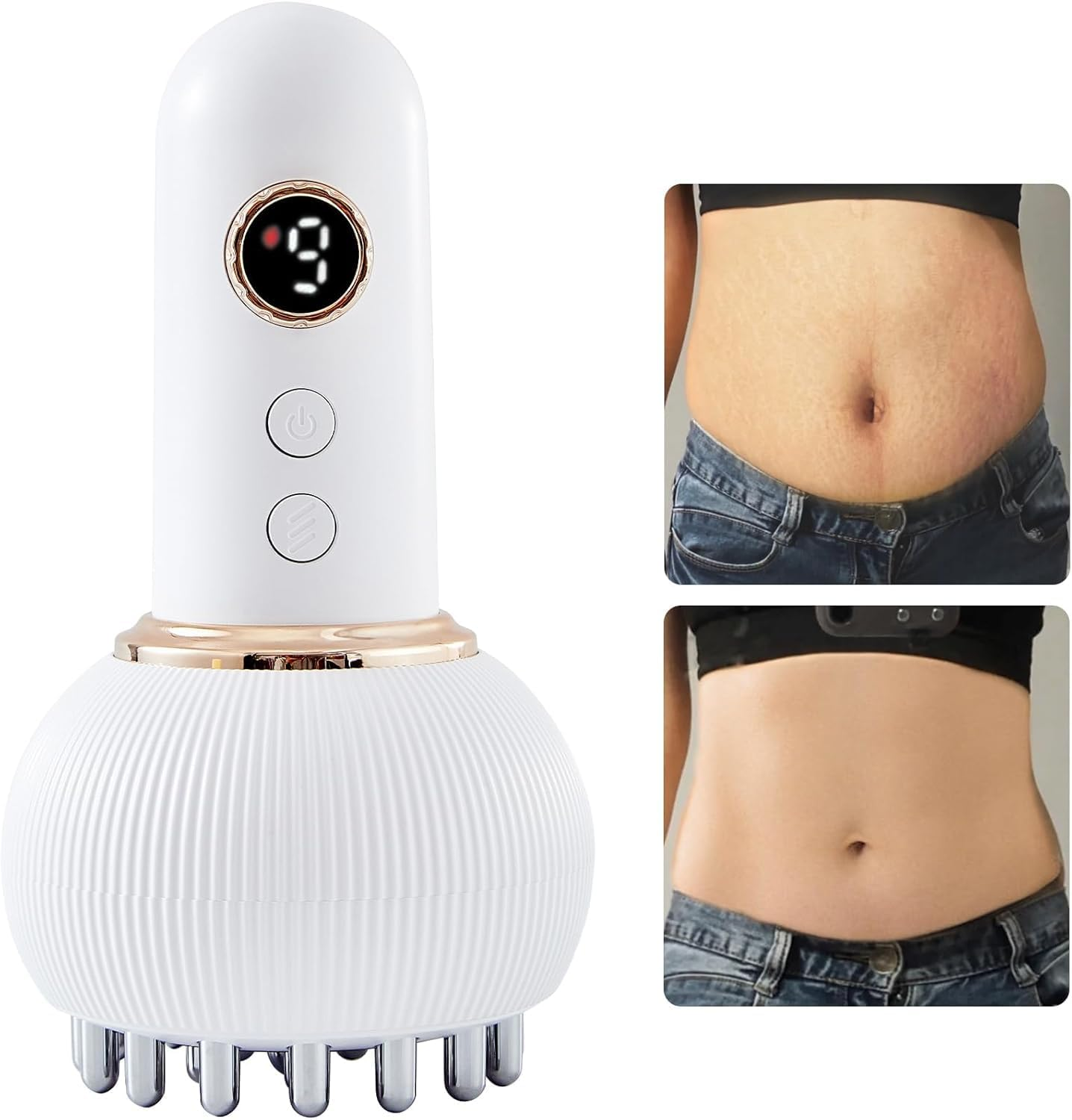 Lymphatic Drainage Massager, anti Cellulite Massage Tool, USB Charging Helps Reduce Stretch Marks Cellulite, for Legs, Arms, Belly, Body Sculpting Machine with Microcurrent, Light, Heat Vibration (White)