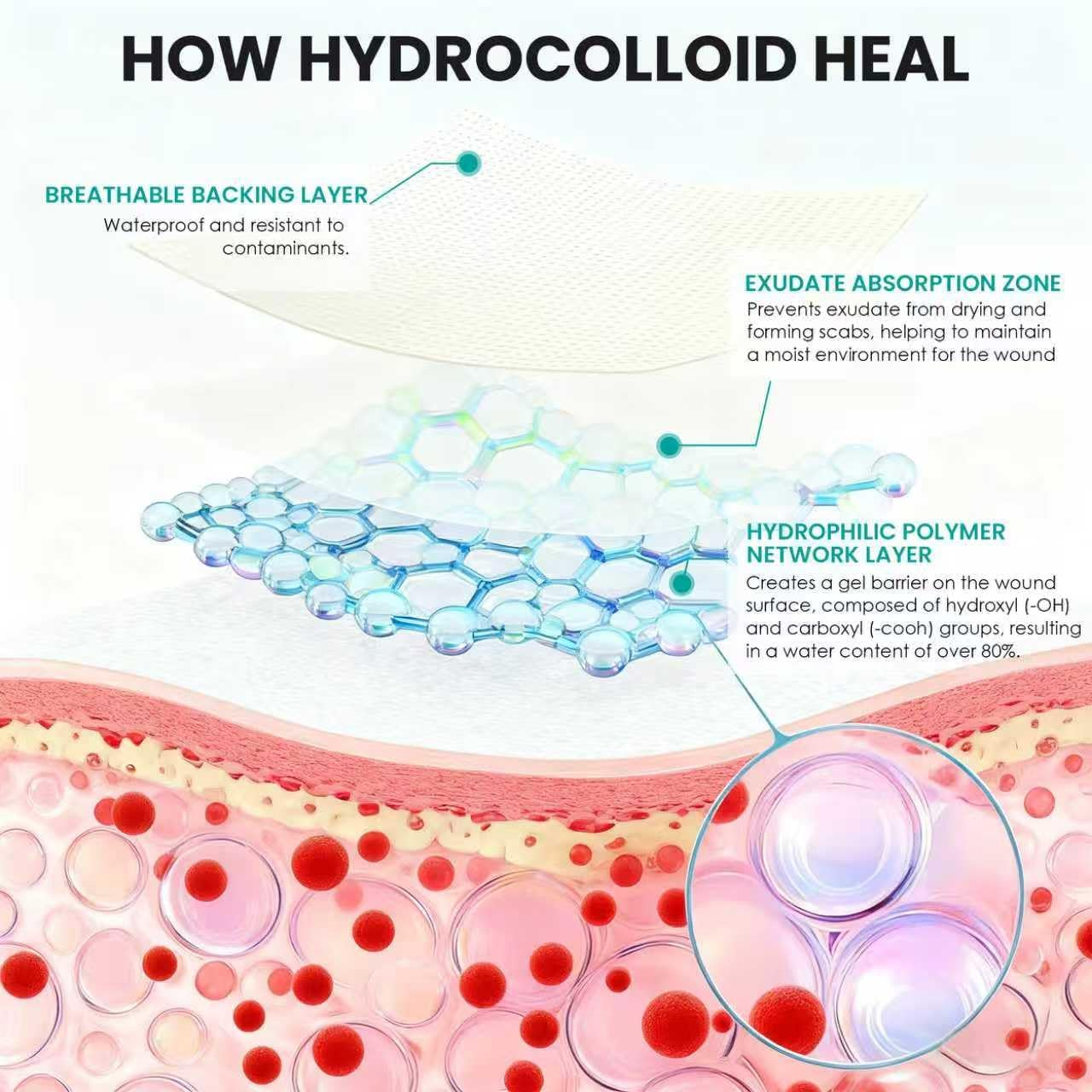 Medical-Grade Hydrocolloid Roll for Wound Care: 5Cm &times; 3.6M Hydrocolloid Bandages, Cut-To-Size Self-Adhesive Patch Dressing, Waterproof & Ultra Absorbent Tape for Burns, Blisters, Acne, First Aid Kit image number 1