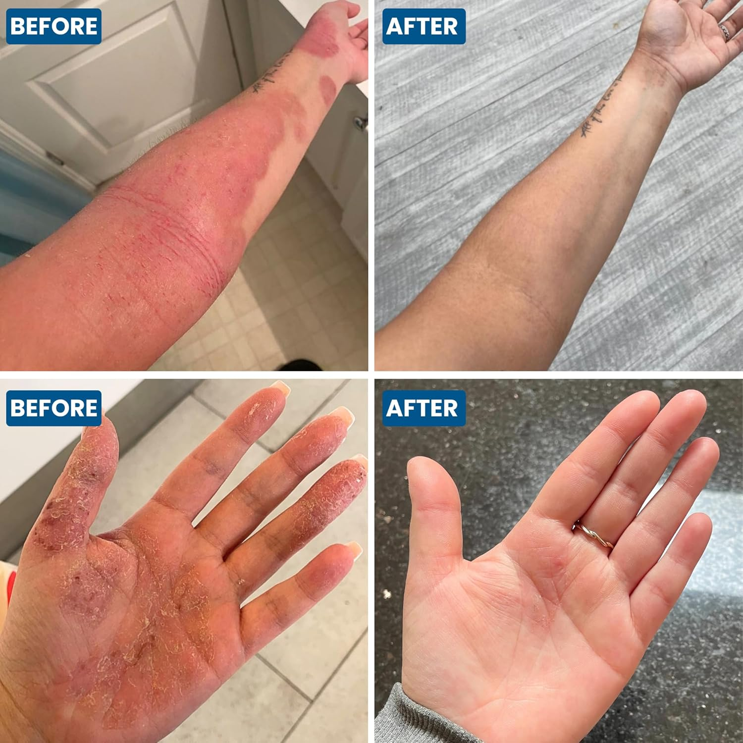 Grahams Natural C+ Eczema Dermatitis Cream, 50 Grams image number 6